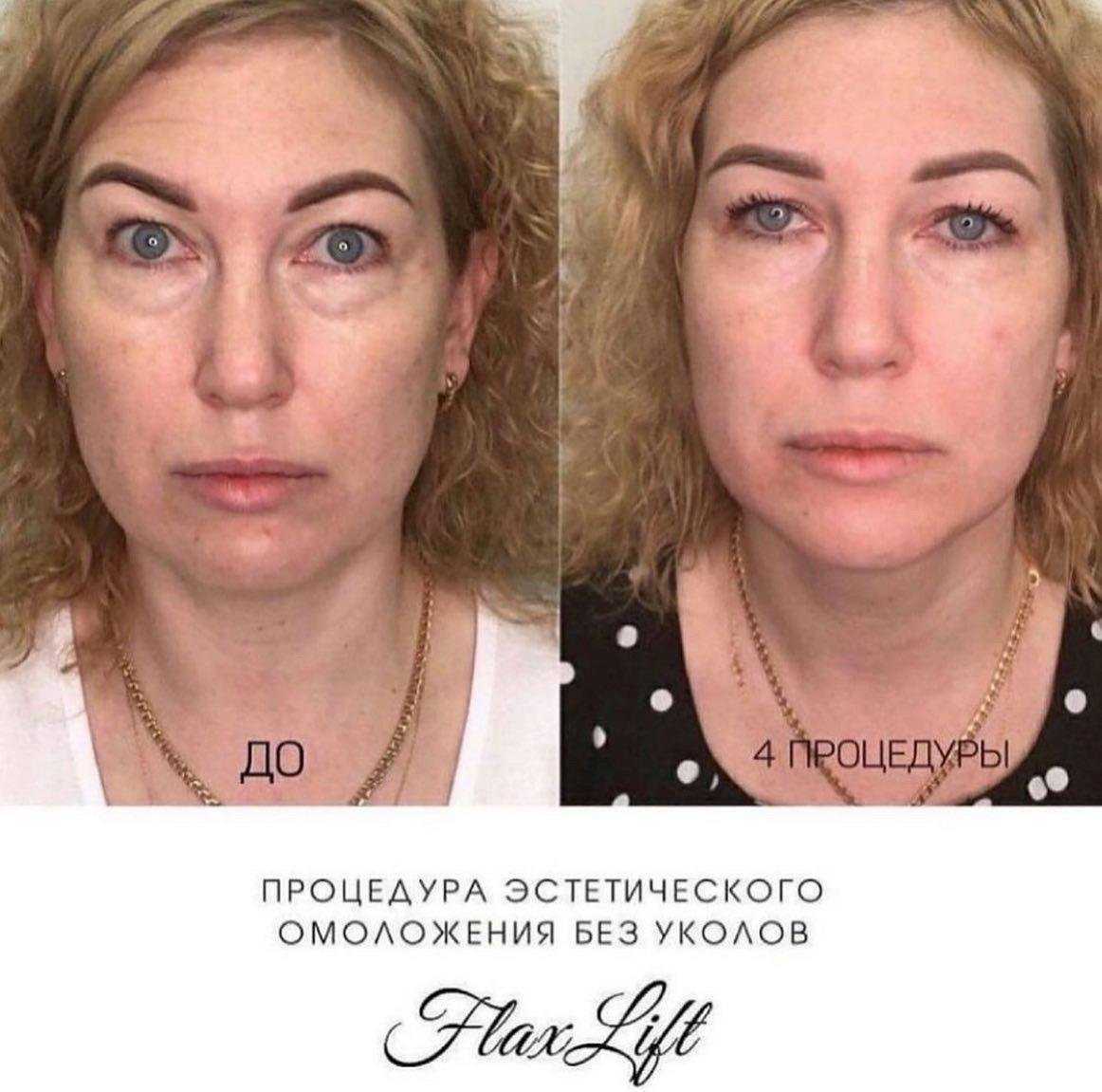 Отзывы на компанию Flaxtap в Красноярске c фото