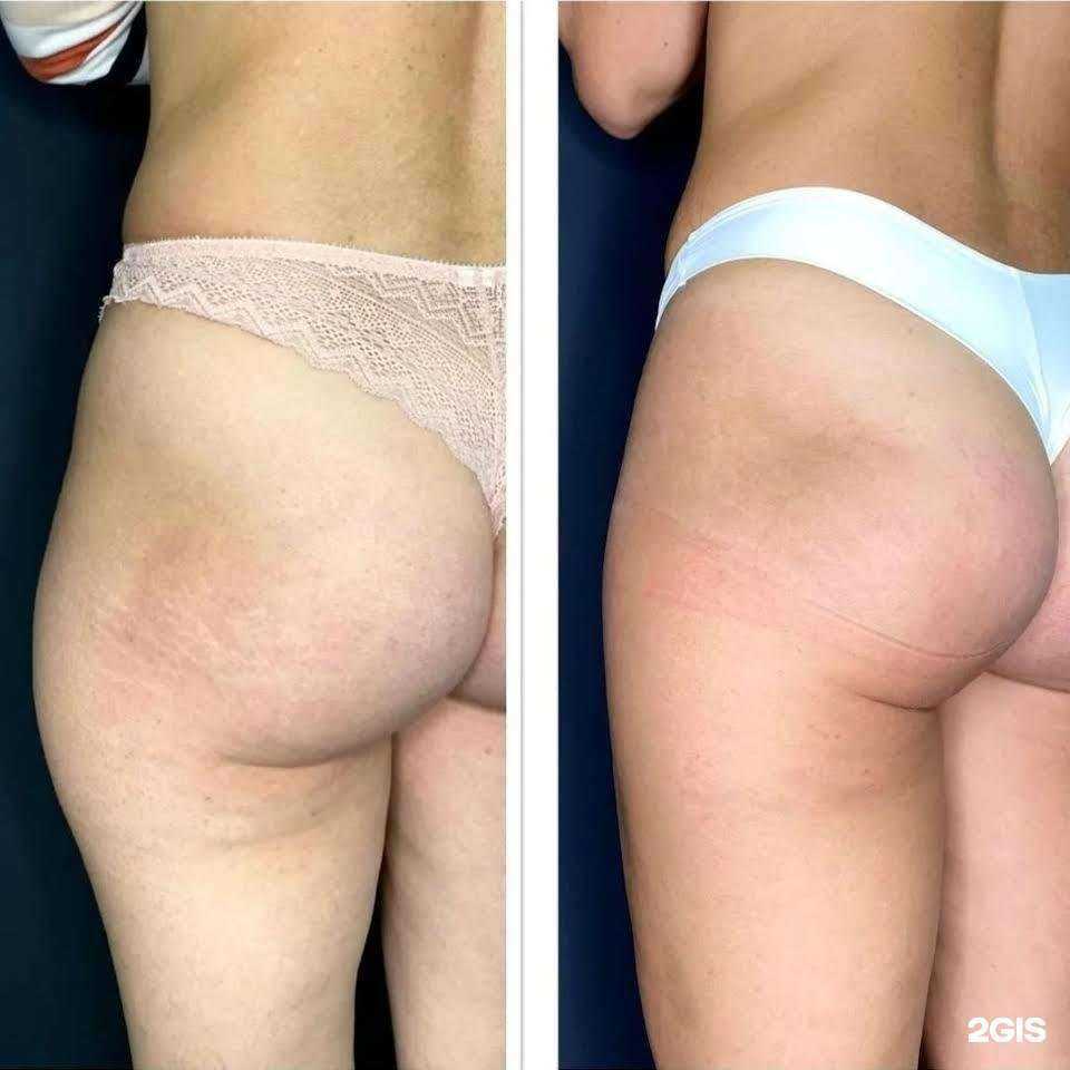 Отзывы на компанию Ажур в г. Асбест c фото