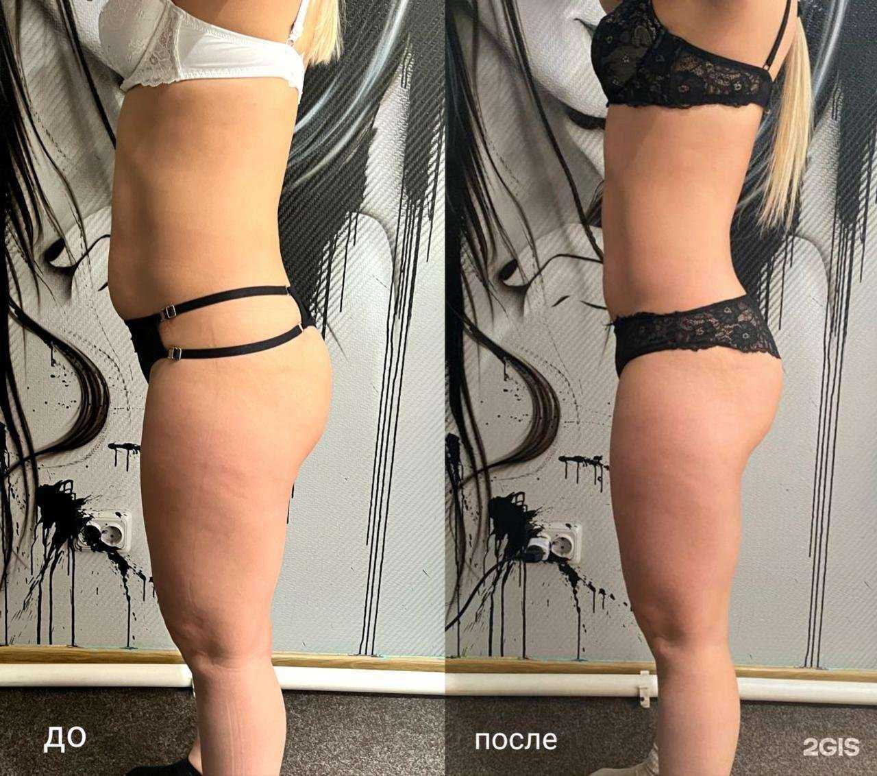 Отзывы на компанию BodySlim41 в г. Петропавловск-Камчатский c фото