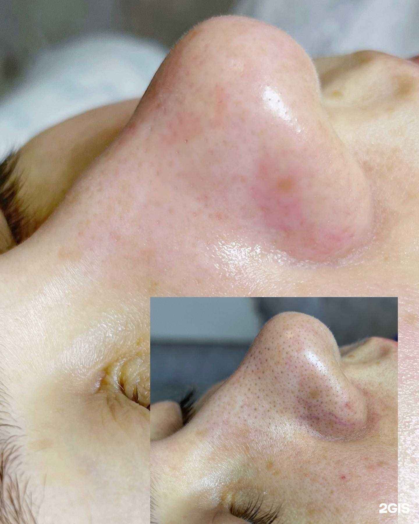 Отзывы на компанию Clean Skin в г. Сочи c фото