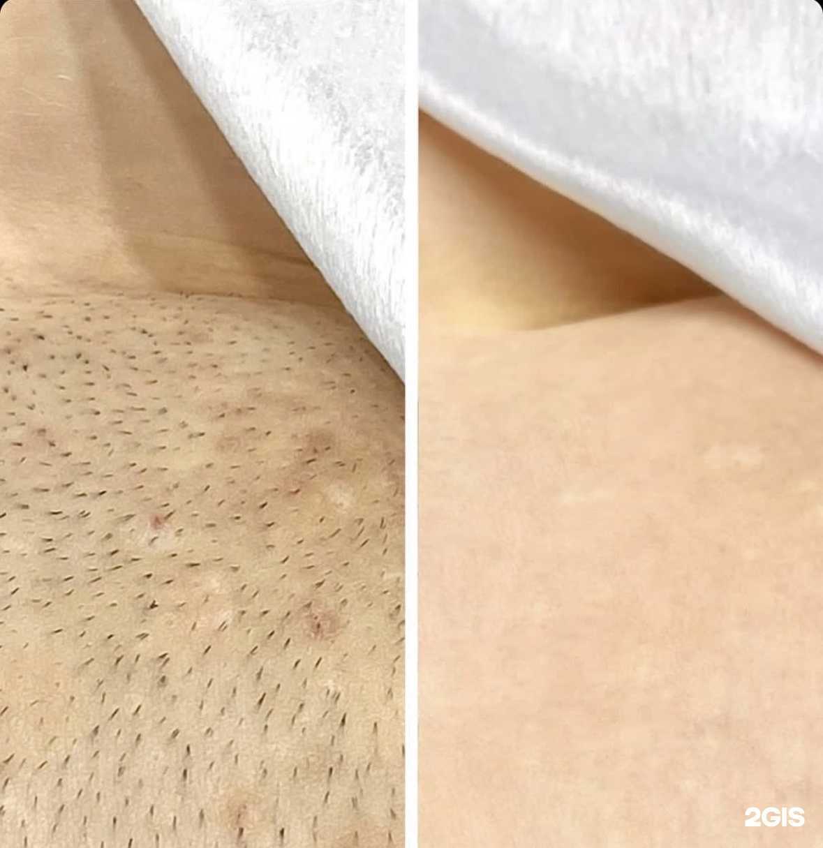 Отзывы на компанию Epil studio в Воронеже c фото