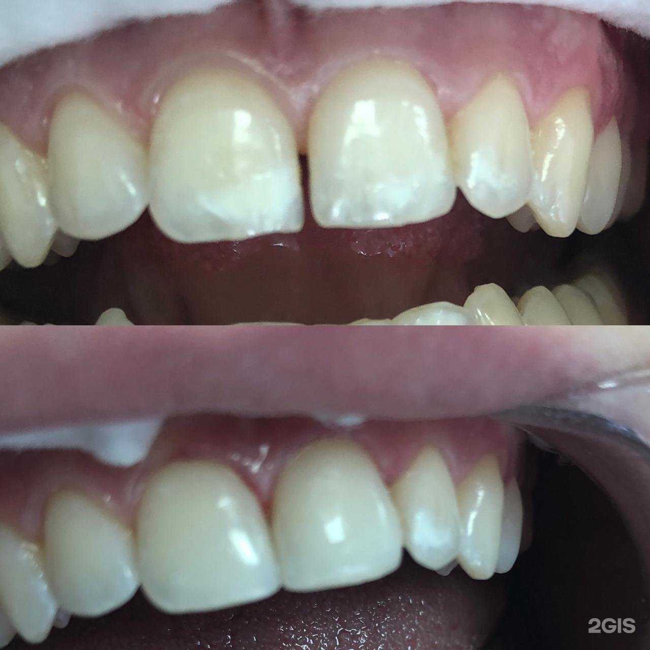 Отзывы на компанию Дантист-А в г. Новосибирск c фото