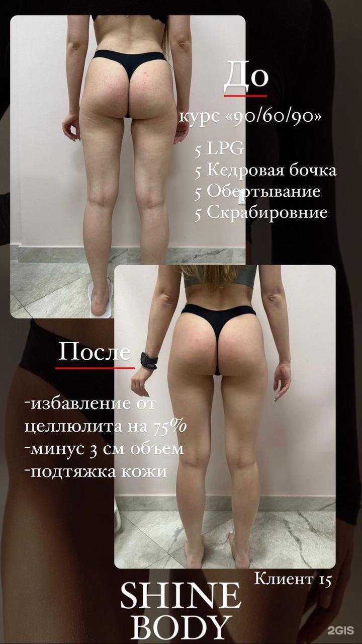 Отзывы на компанию Shine_Body в Ростове-на-Дону c фото