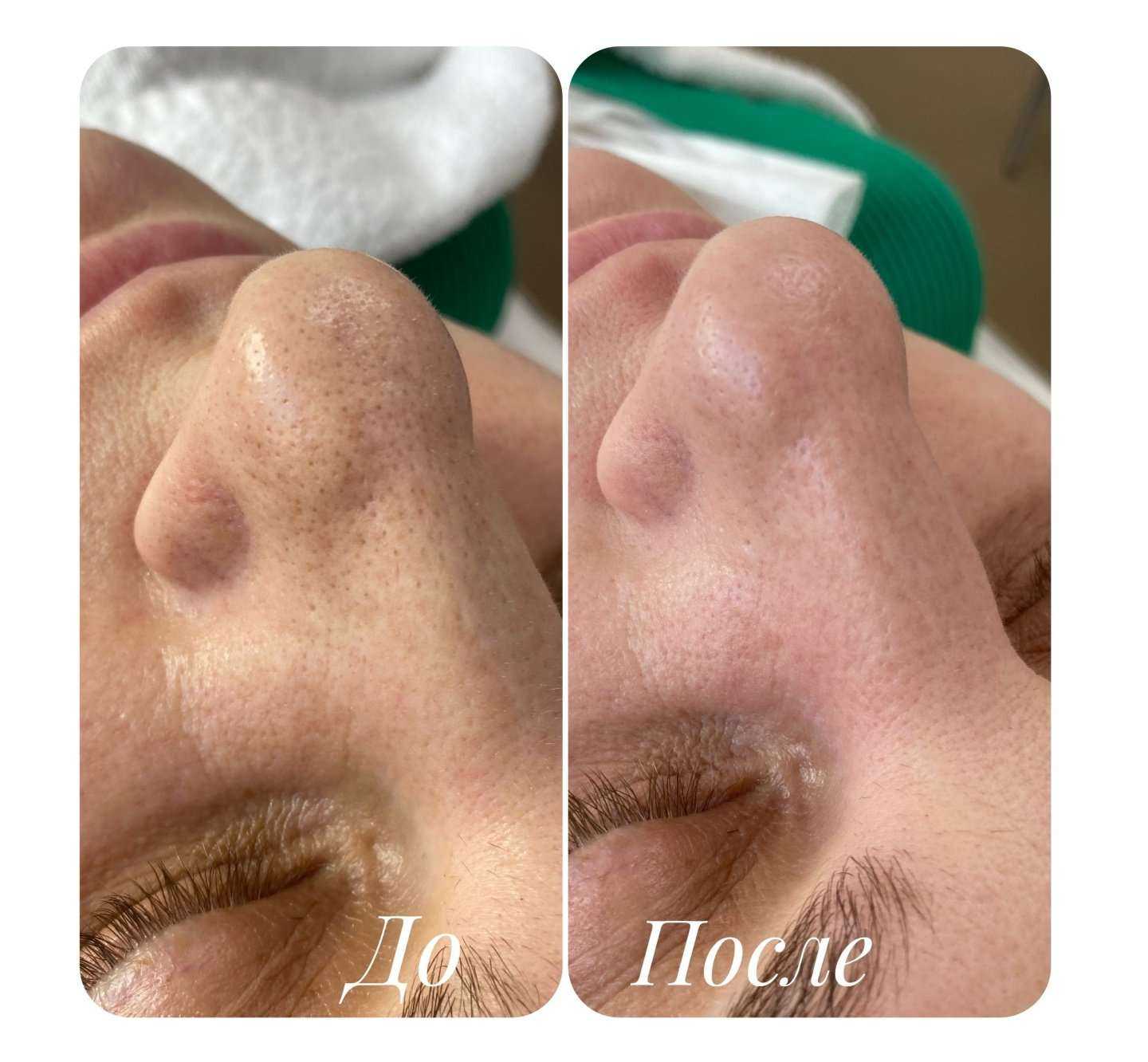 Отзывы на компанию Кабинет косметолога в Хабаровске c фото