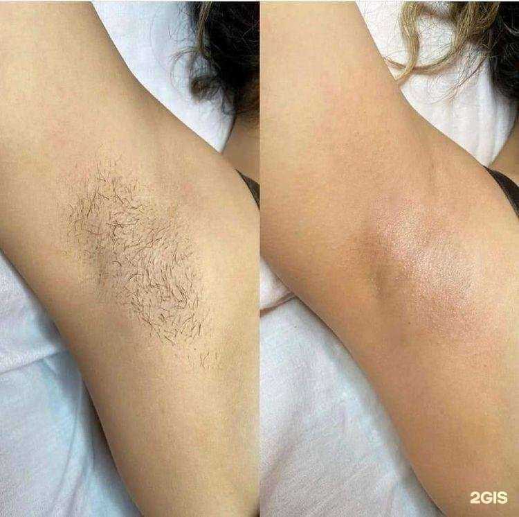Отзывы на компанию Студия лазерной эпиляция в Томске c фото