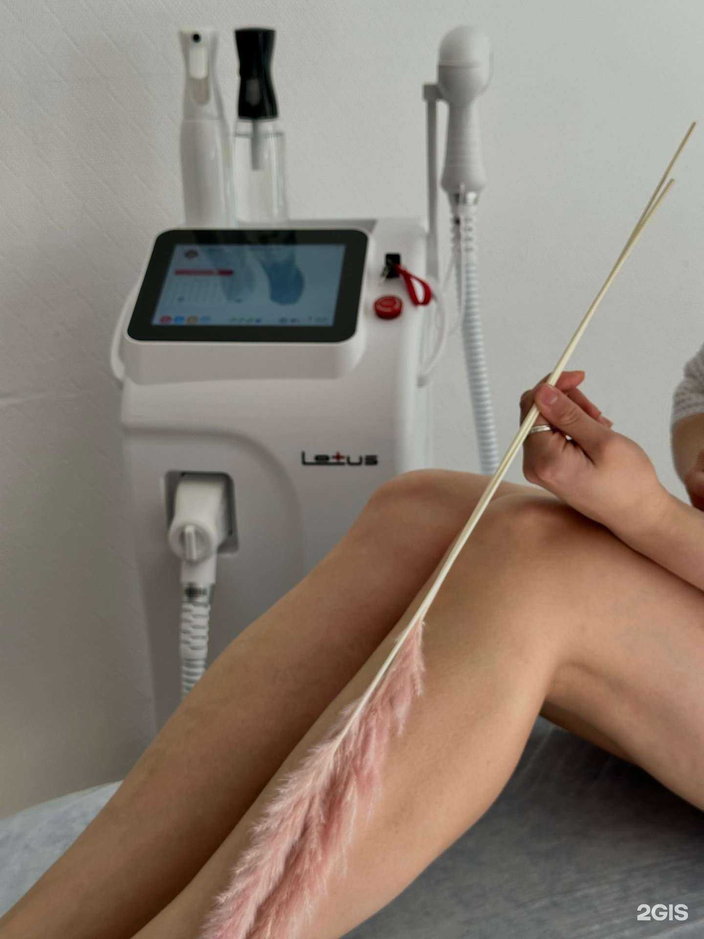 Отзывы на компанию Iq laser в Вологде c фото