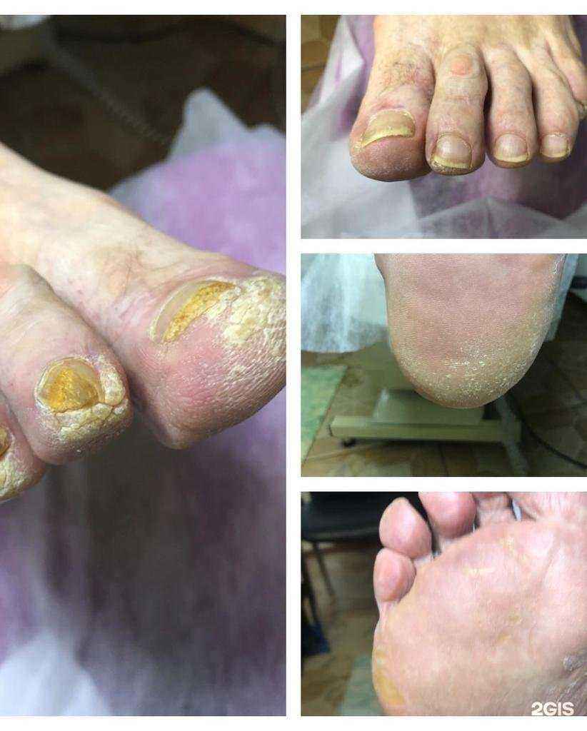 Отзывы на компанию Центр профессионального педикюра и подологии в Волгограде c фото