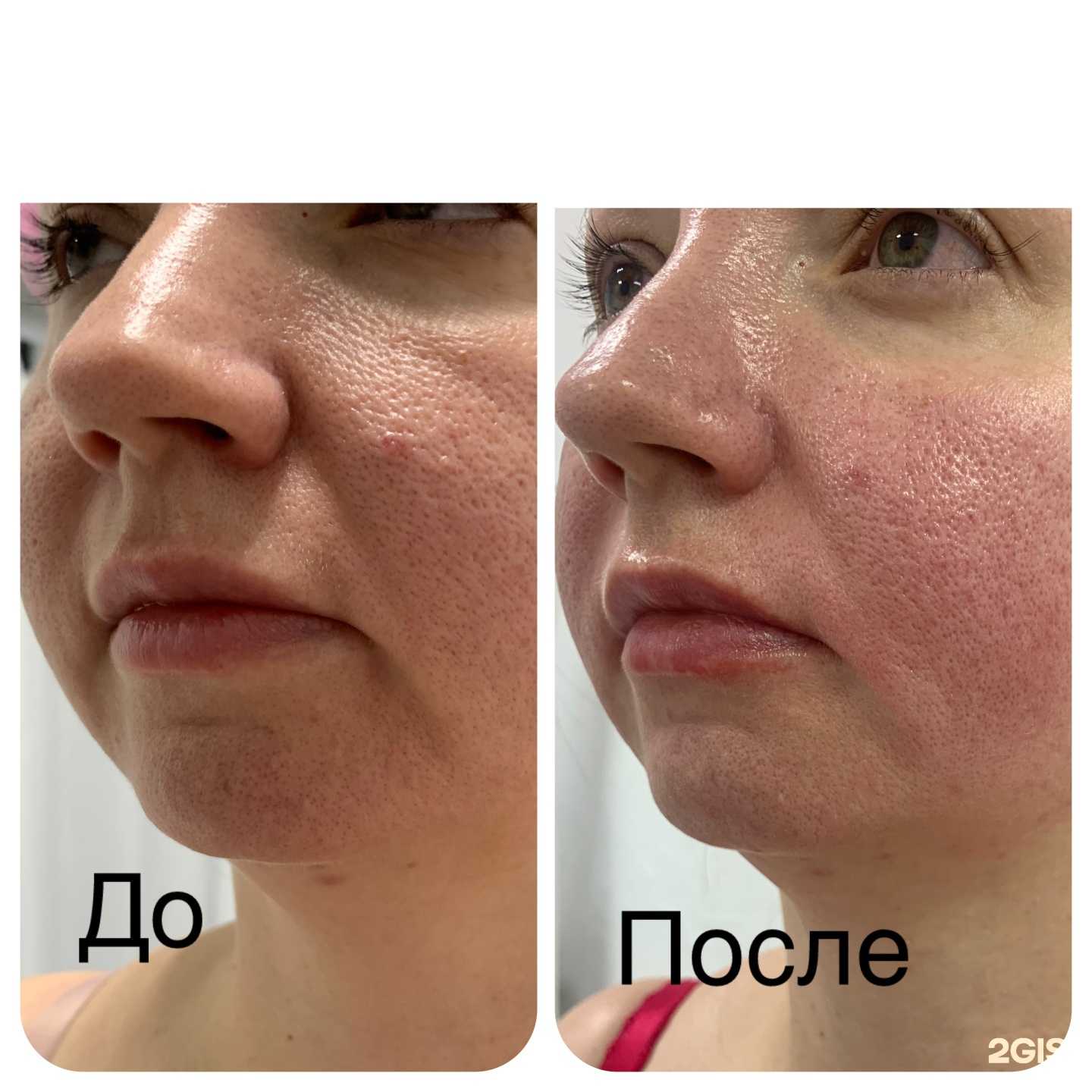 Отзывы на компанию Кабинет массажа и косметолога в г. Барнаул c фото