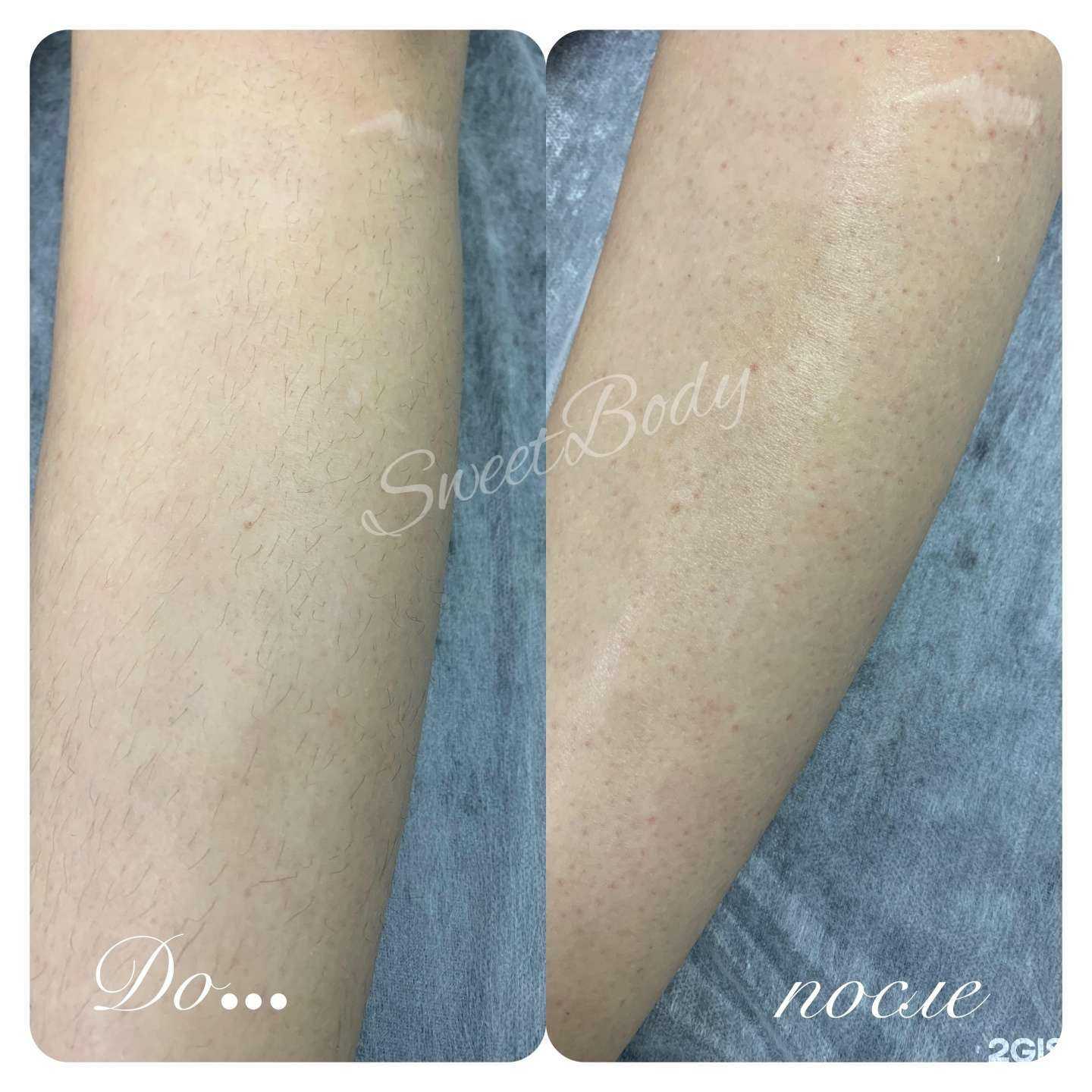 Отзывы на компанию SweetBody в Липецке c фото