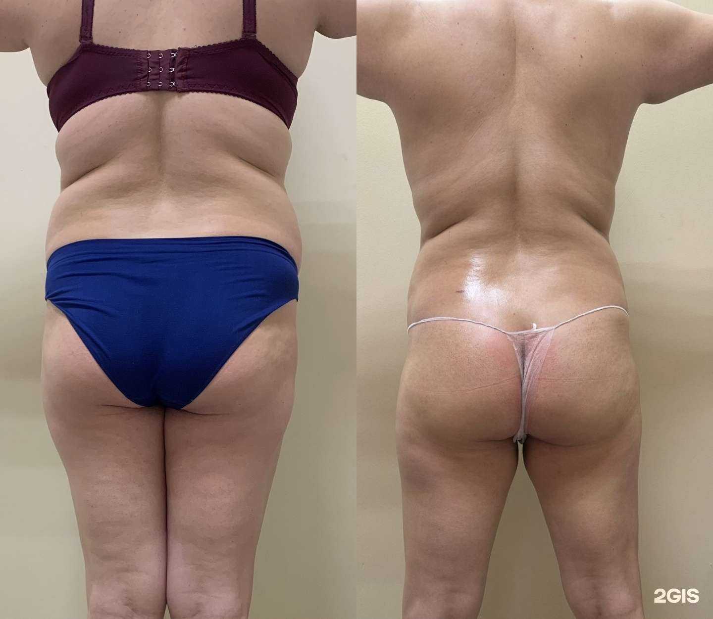 Отзывы на компанию Perfectbody tmb в г. Тамбов c фото