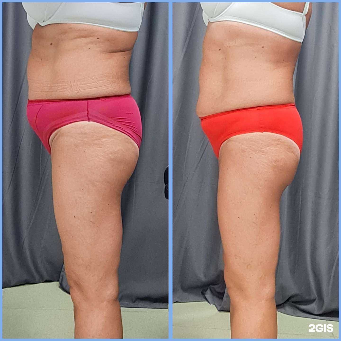 Отзывы на компанию Эстетика Центр в Артёме c фото