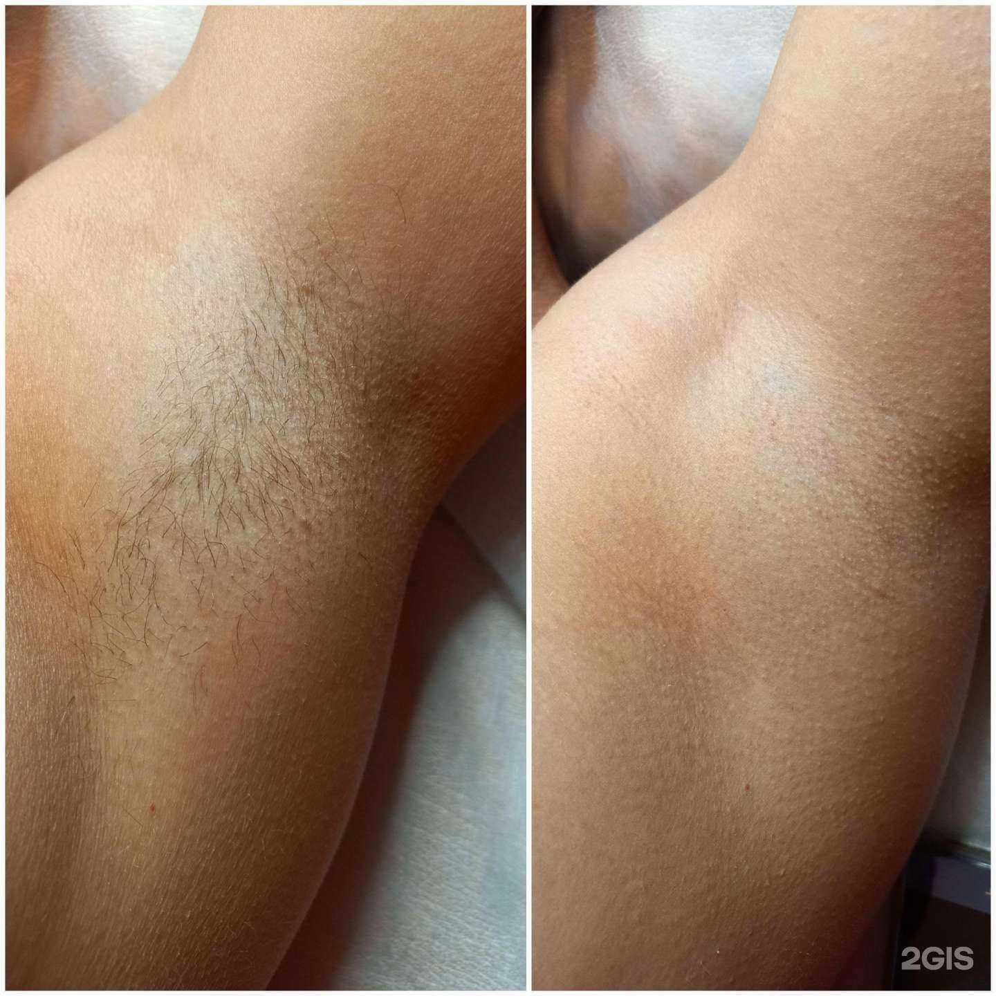 Отзывы на компанию Студия депиляции и эстетического ухода за лицом и телом в г. Архангельск c фото