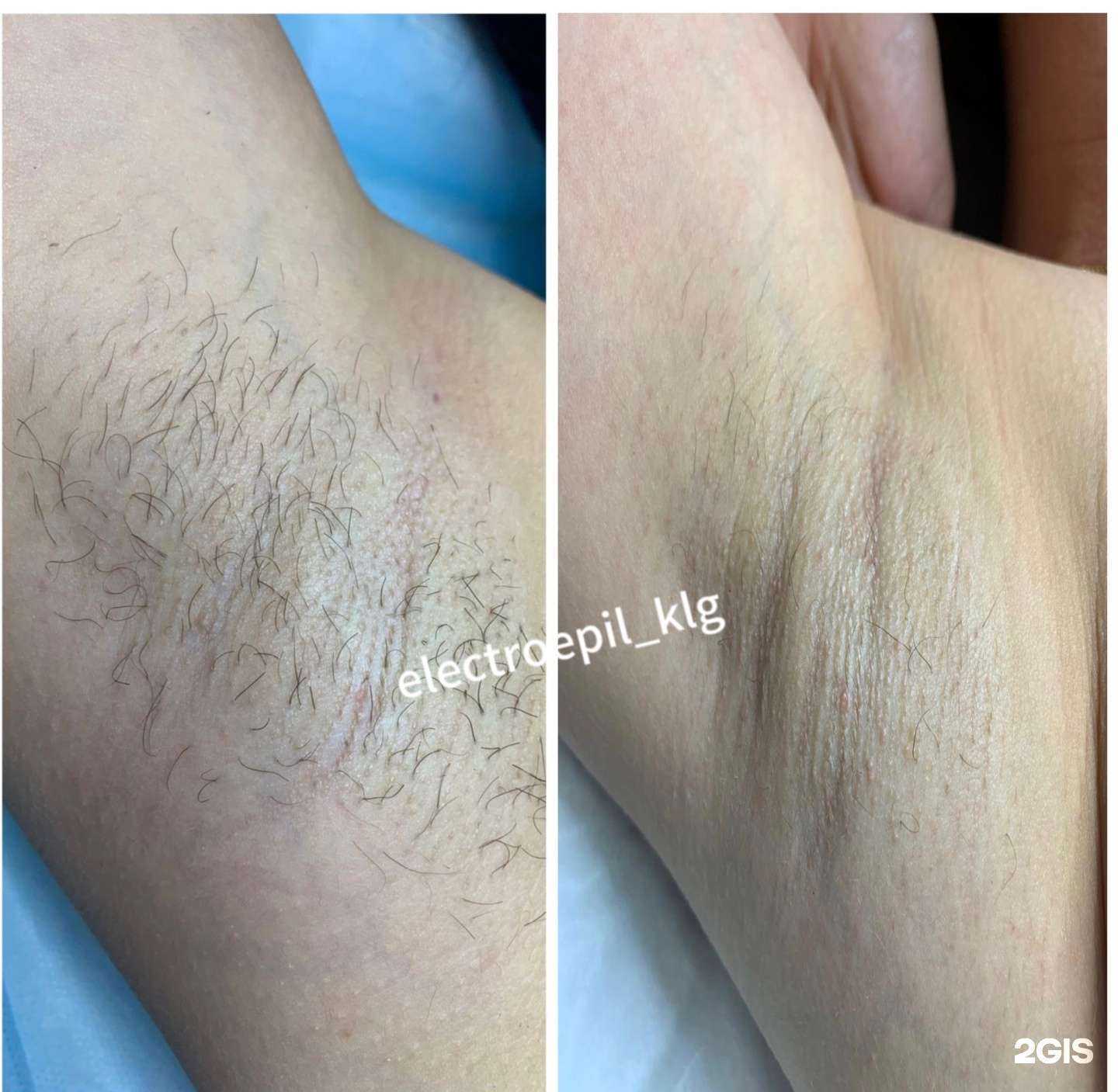Отзывы на компанию Студия электроэпиляции в г. Калуга c фото