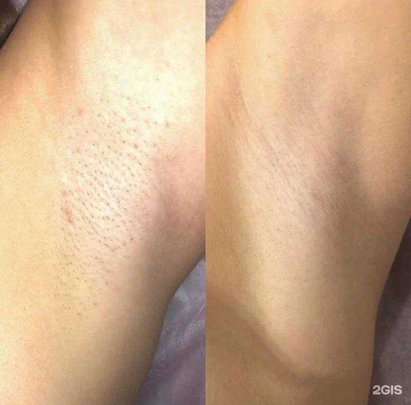 Отзывы на компанию Love бикини в Батайске c фото