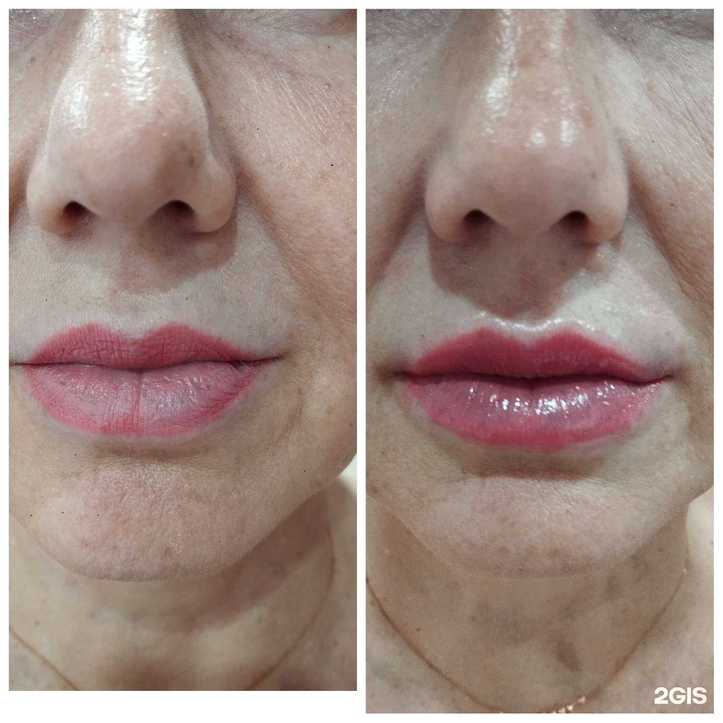 Отзывы на компанию Ломель в г. Анапа c фото