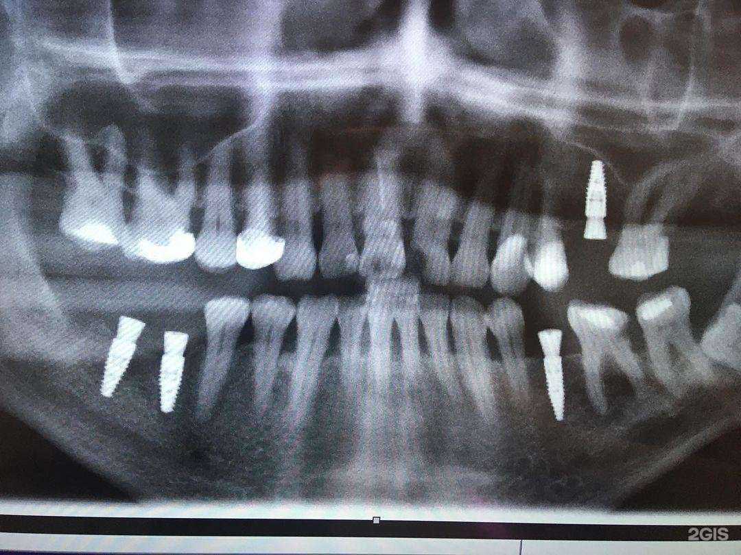 Отзывы на компанию dentStar clinic в Ростове-на-Дону c фото