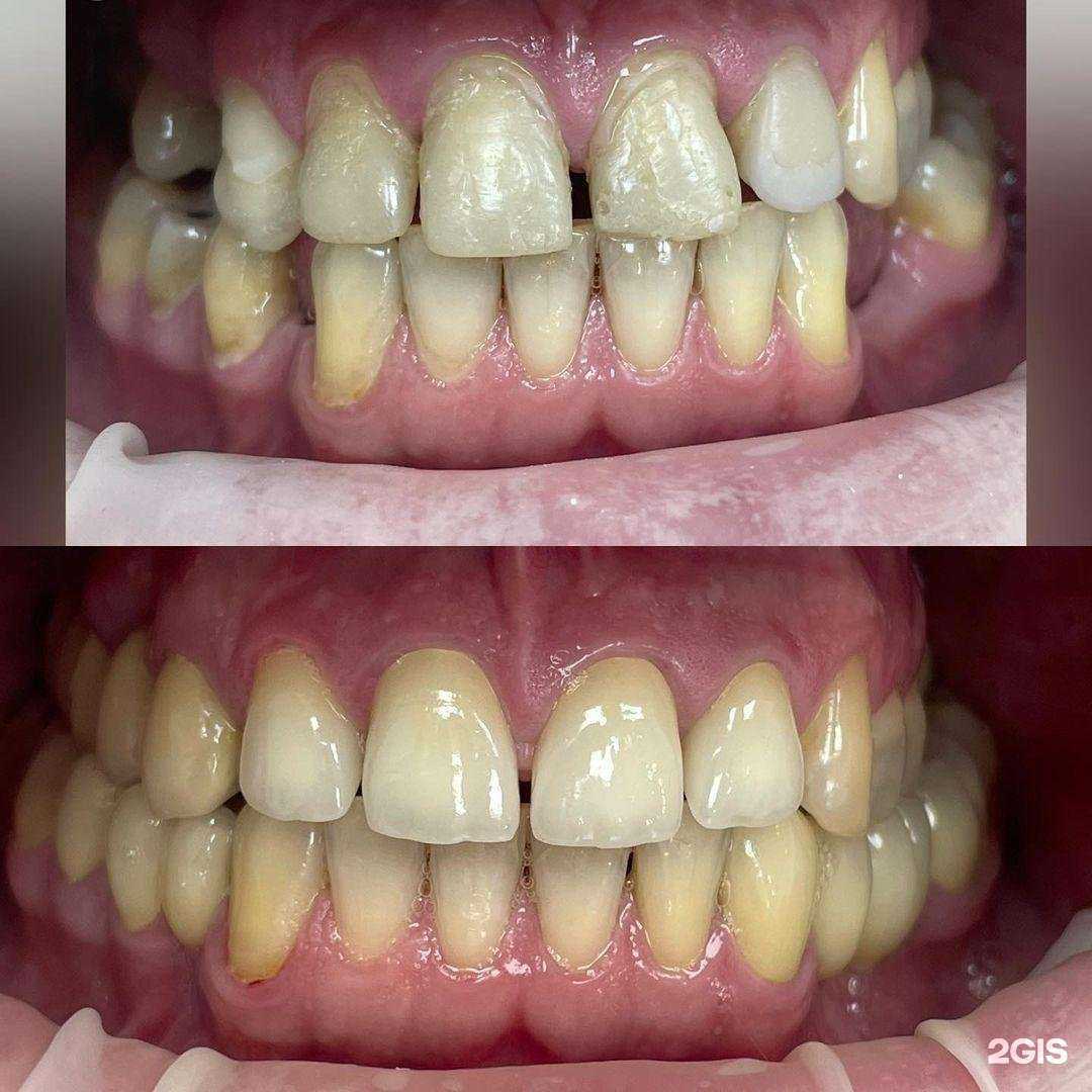 Отзывы на компанию ОртоДент в Нефтеюганске c фото