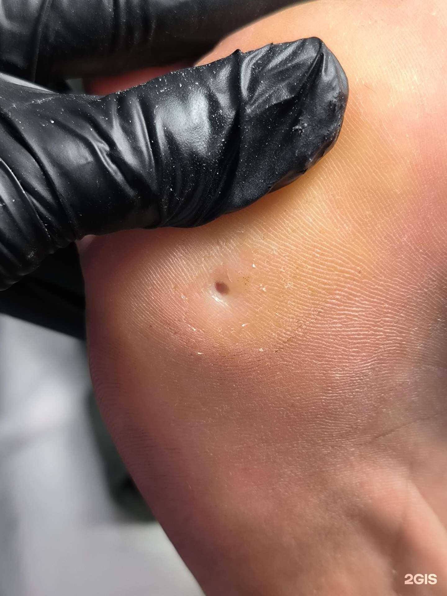 Отзывы на компанию Студия подологии в Краснодаре c фото