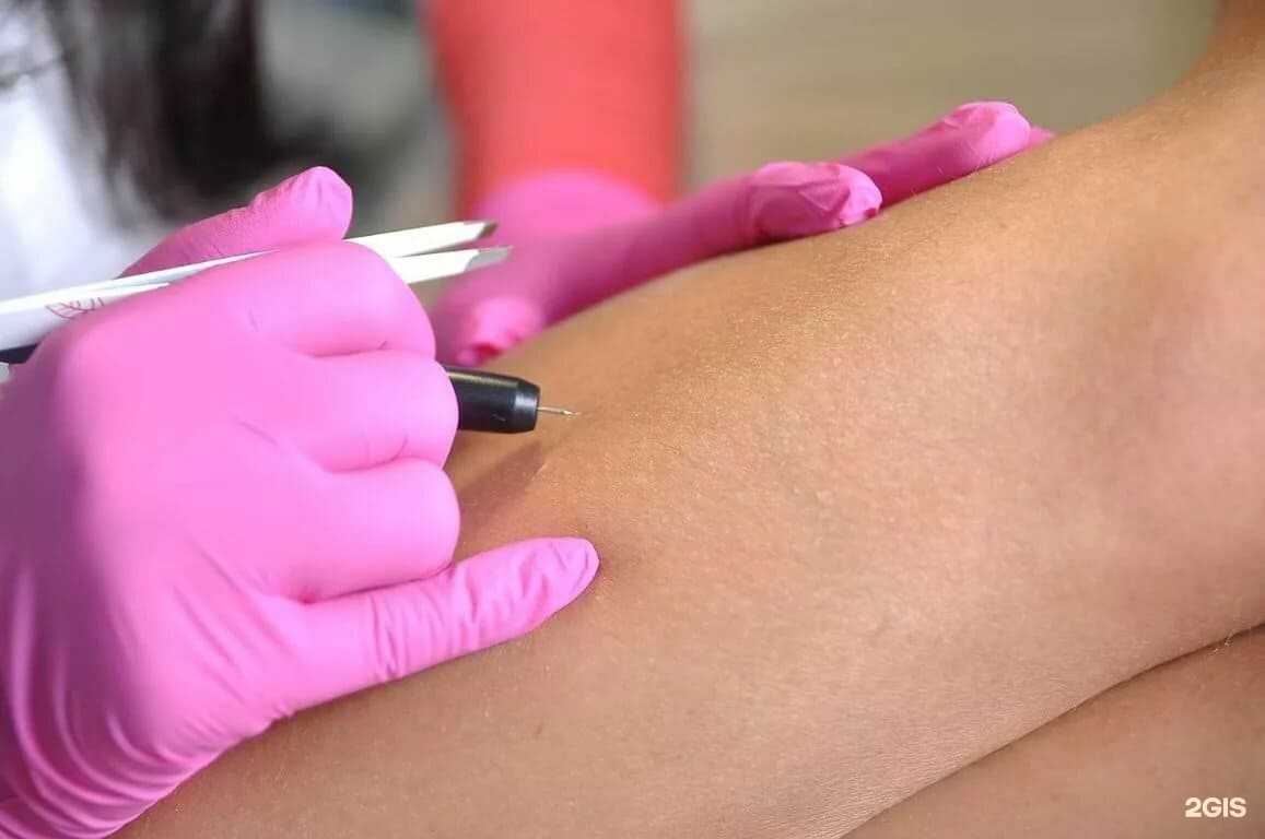 Отзывы на компанию Студия электроэпиляции в г. Краснодар c фото