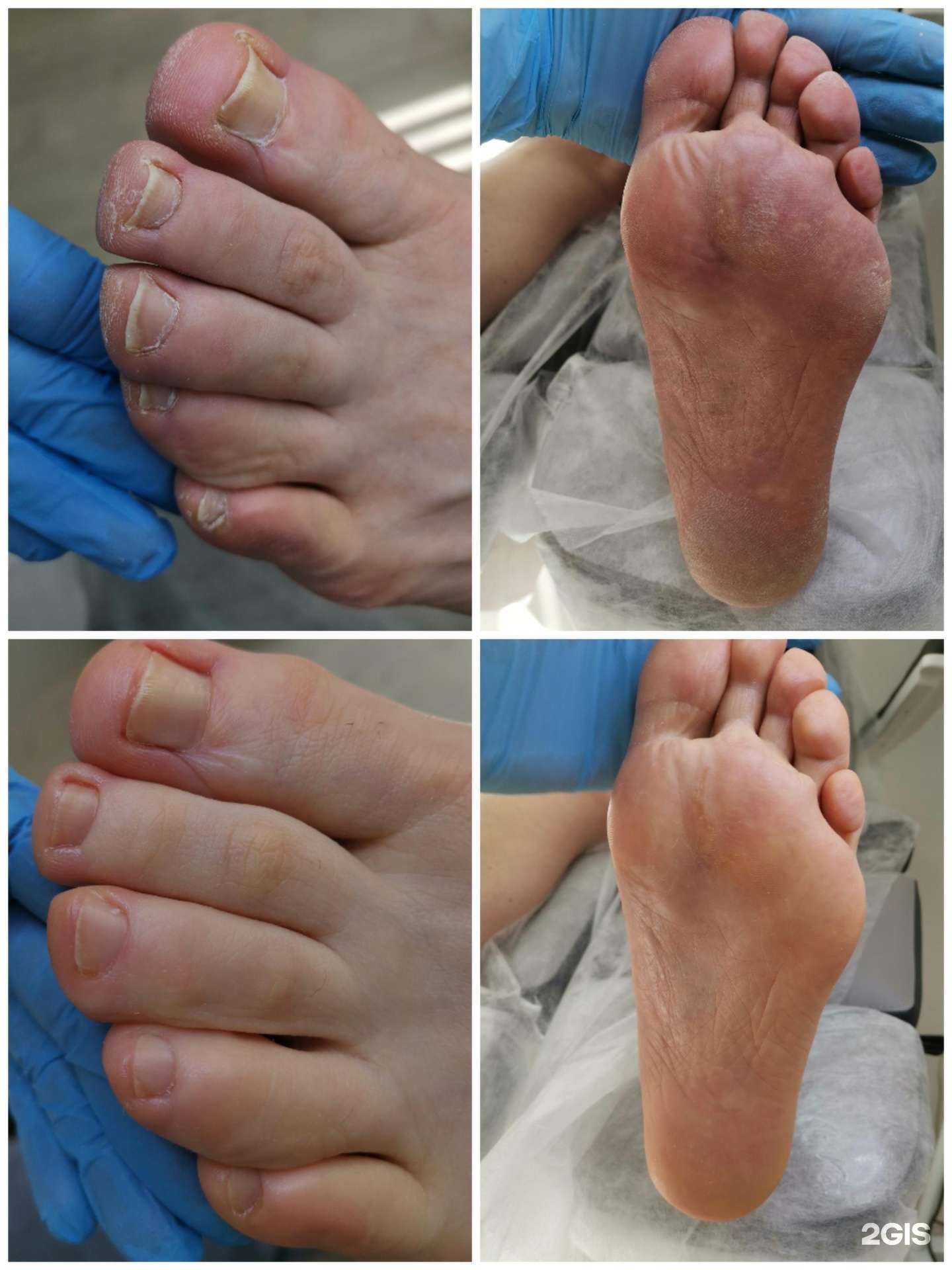 Отзывы на компанию Студия аппаратного маникюра и педикюра в г. Северск c фото