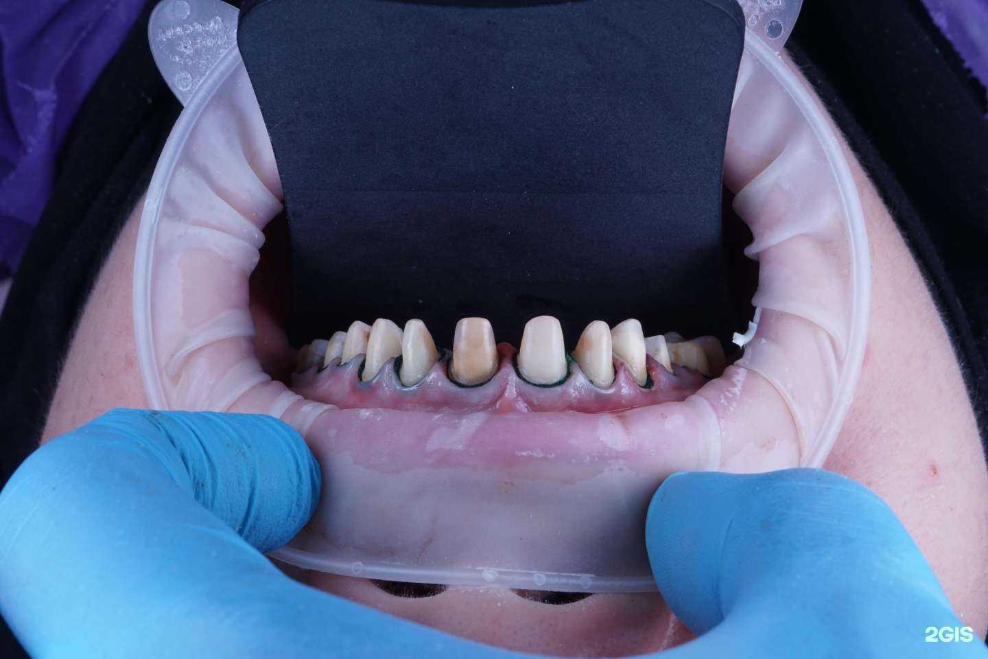 Отзывы на компанию Deo Dent в г. Каспийск c фото