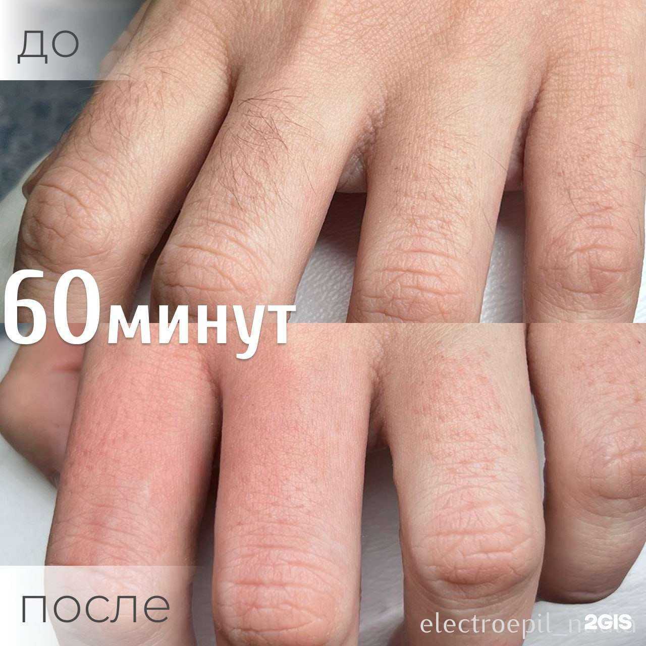 Отзывы на компанию Студия электроэпиляции в Казани c фото