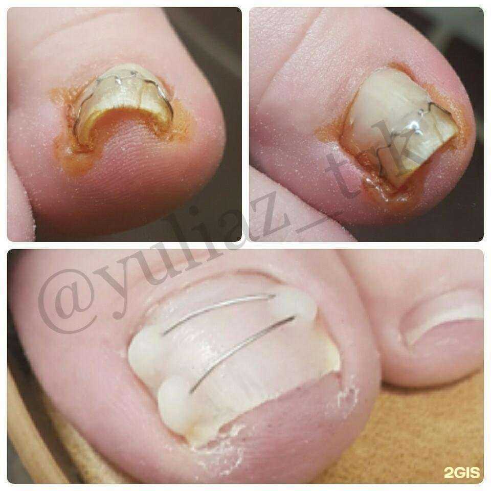 Отзывы на компанию Foot line в Томске c фото