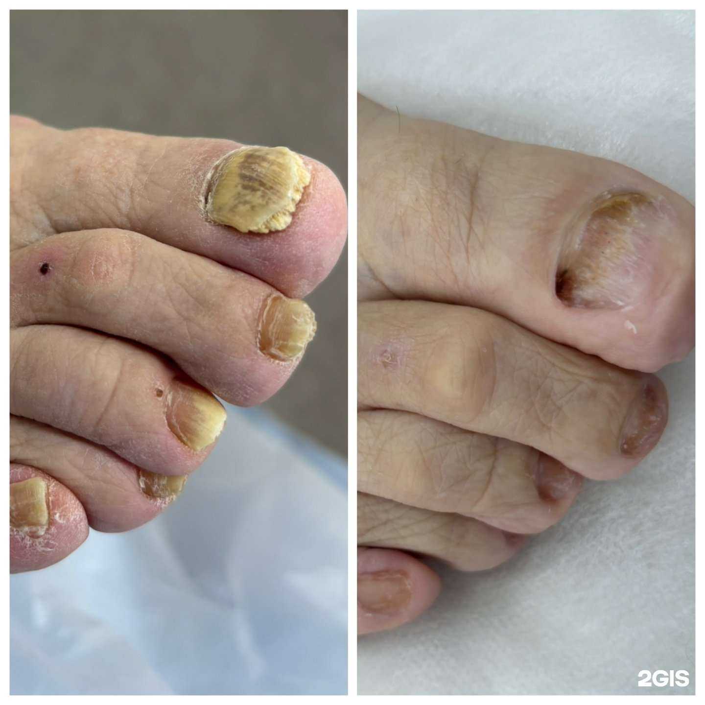 Отзывы на компанию Кабинет подолога Дробот Александры  в Хабаровске c фото