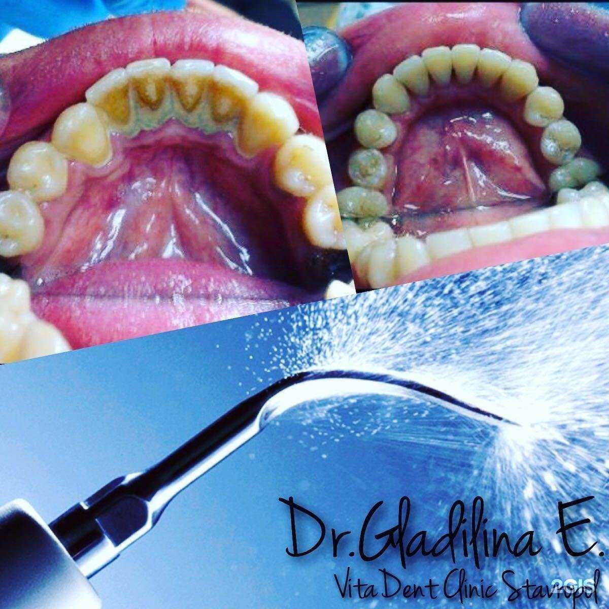 Отзывы на компанию Витадент в Ставрополе c фото