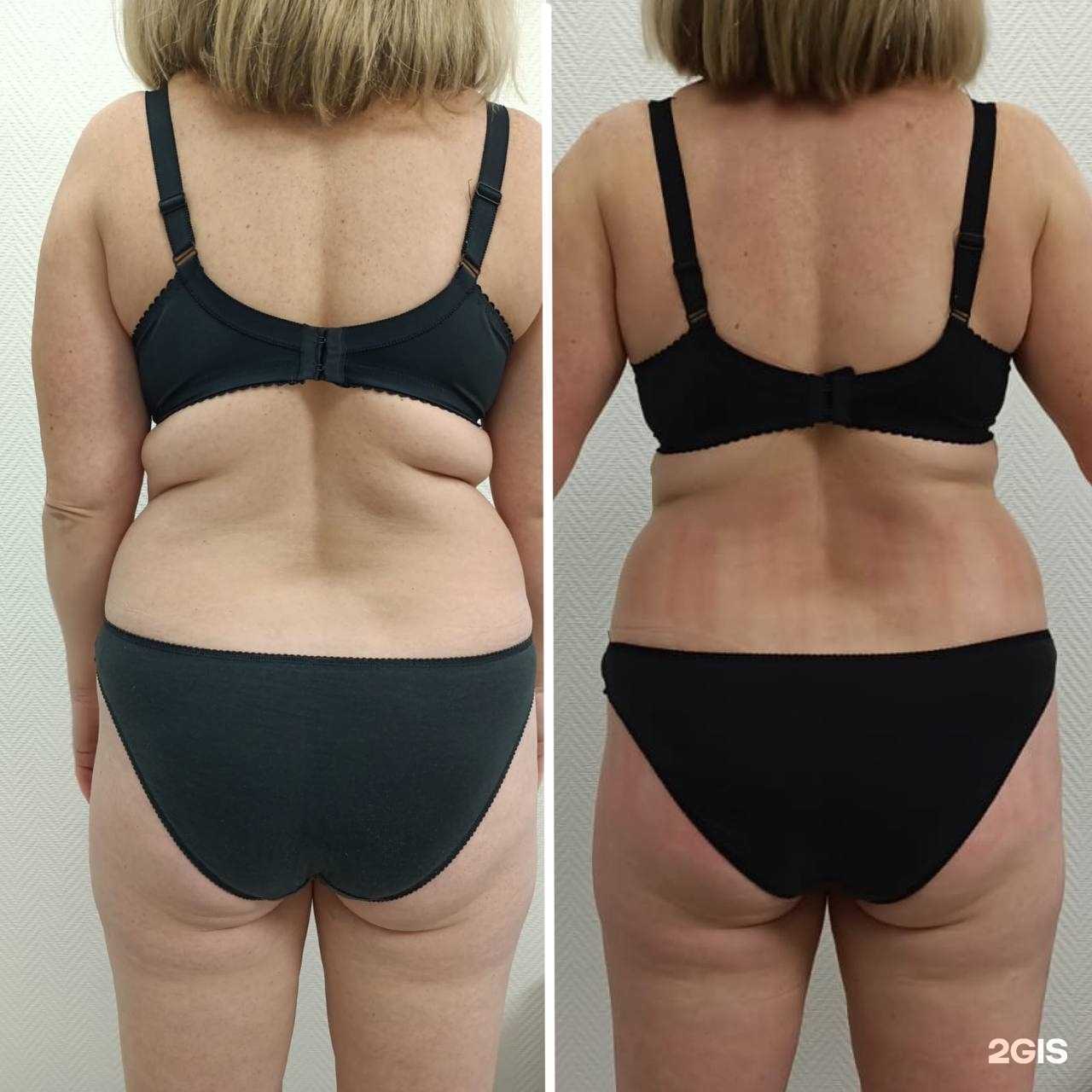 Отзывы на компанию BodyFormula в Пензе c фото