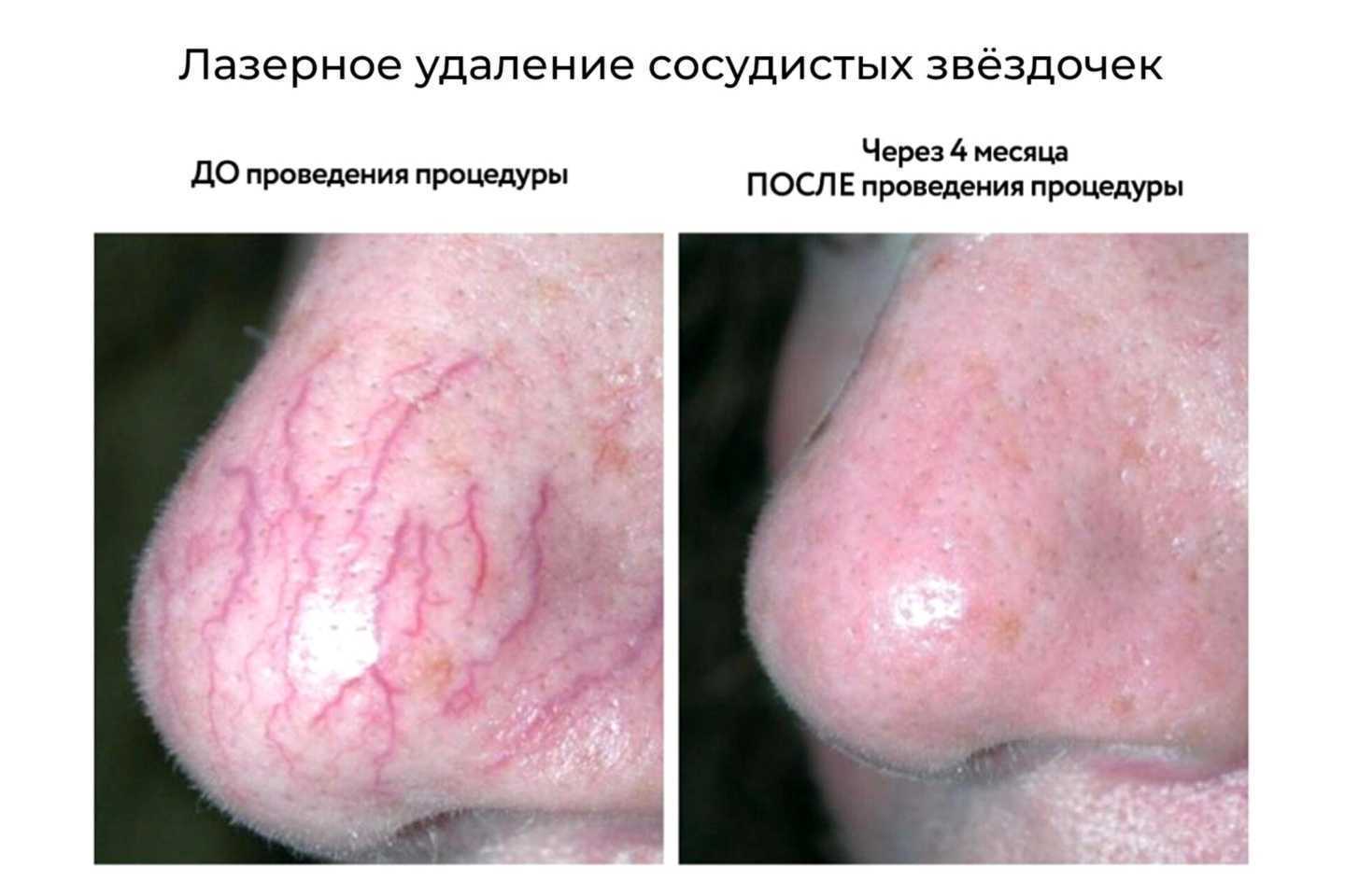 Отзывы на компанию Академия Улыбки в г. Воронеж c фото