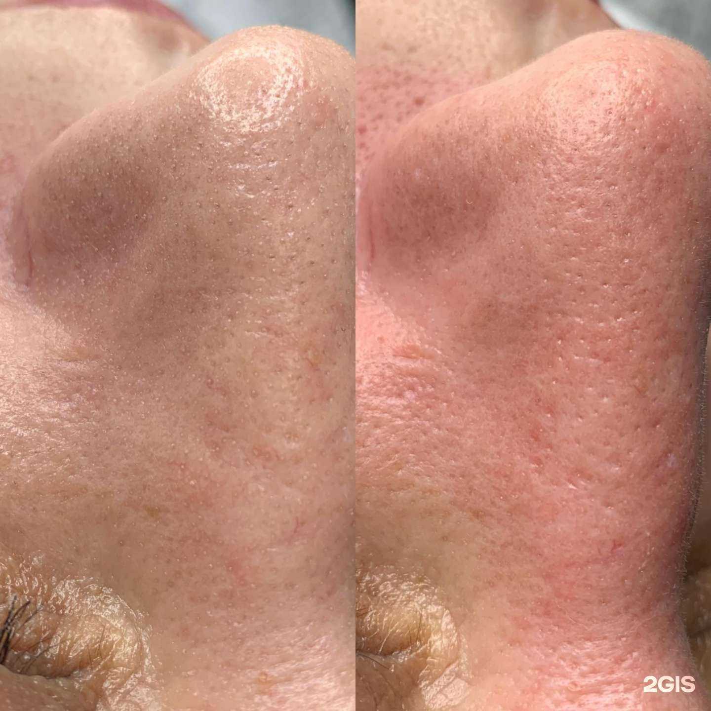 Отзывы на компанию Кабинет эпиляции в г. Анапа c фото