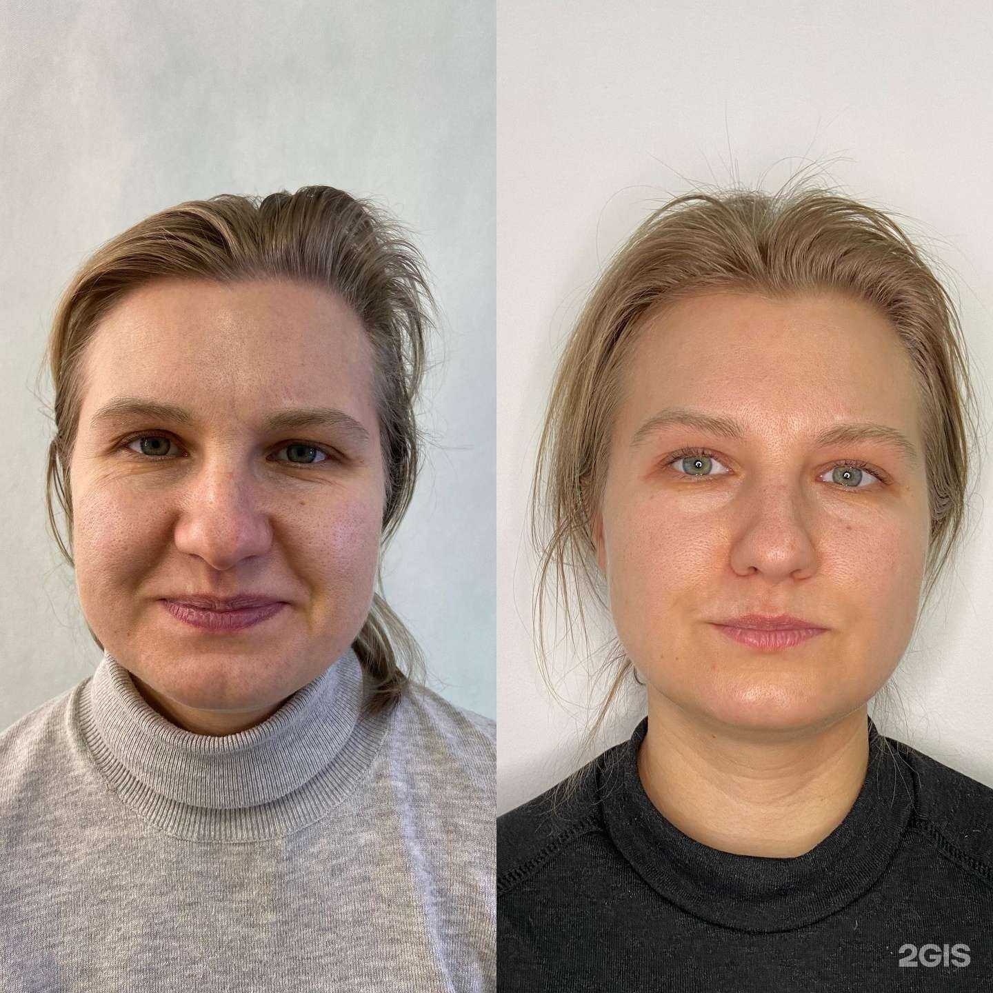 Отзывы на компанию Студия косметологии и массажа в Самаре c фото