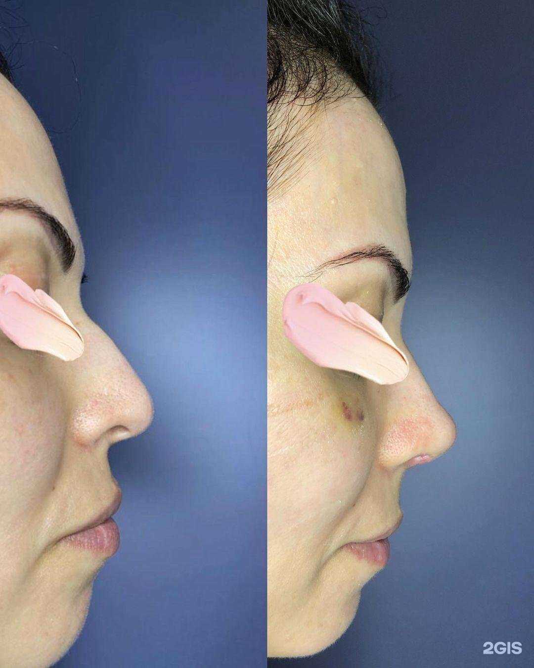 Отзывы на компанию ИнСан в Махачкале c фото