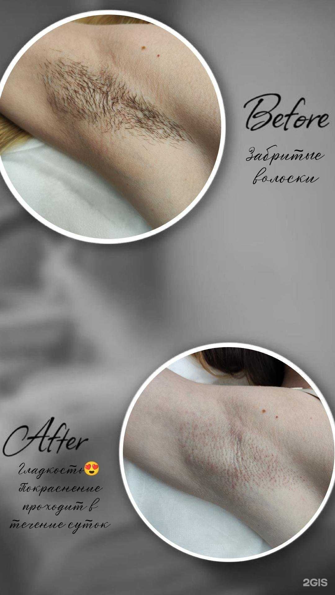 Отзывы на компанию Кабинет эпиляции в Абакане c фото