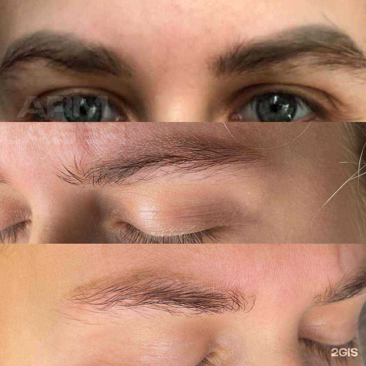 Отзывы на компанию arm_laser в г. Сургут c фото