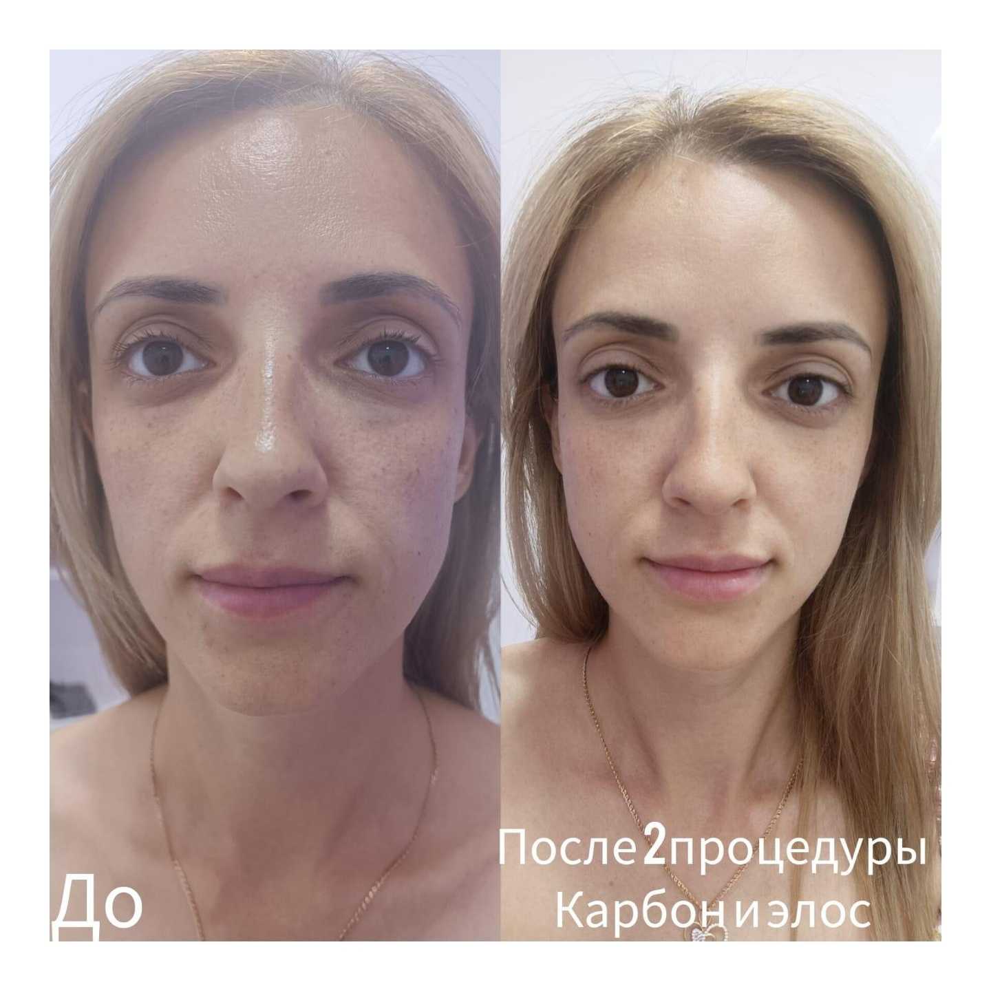 Отзывы на компанию Serebro в Сочи c фото