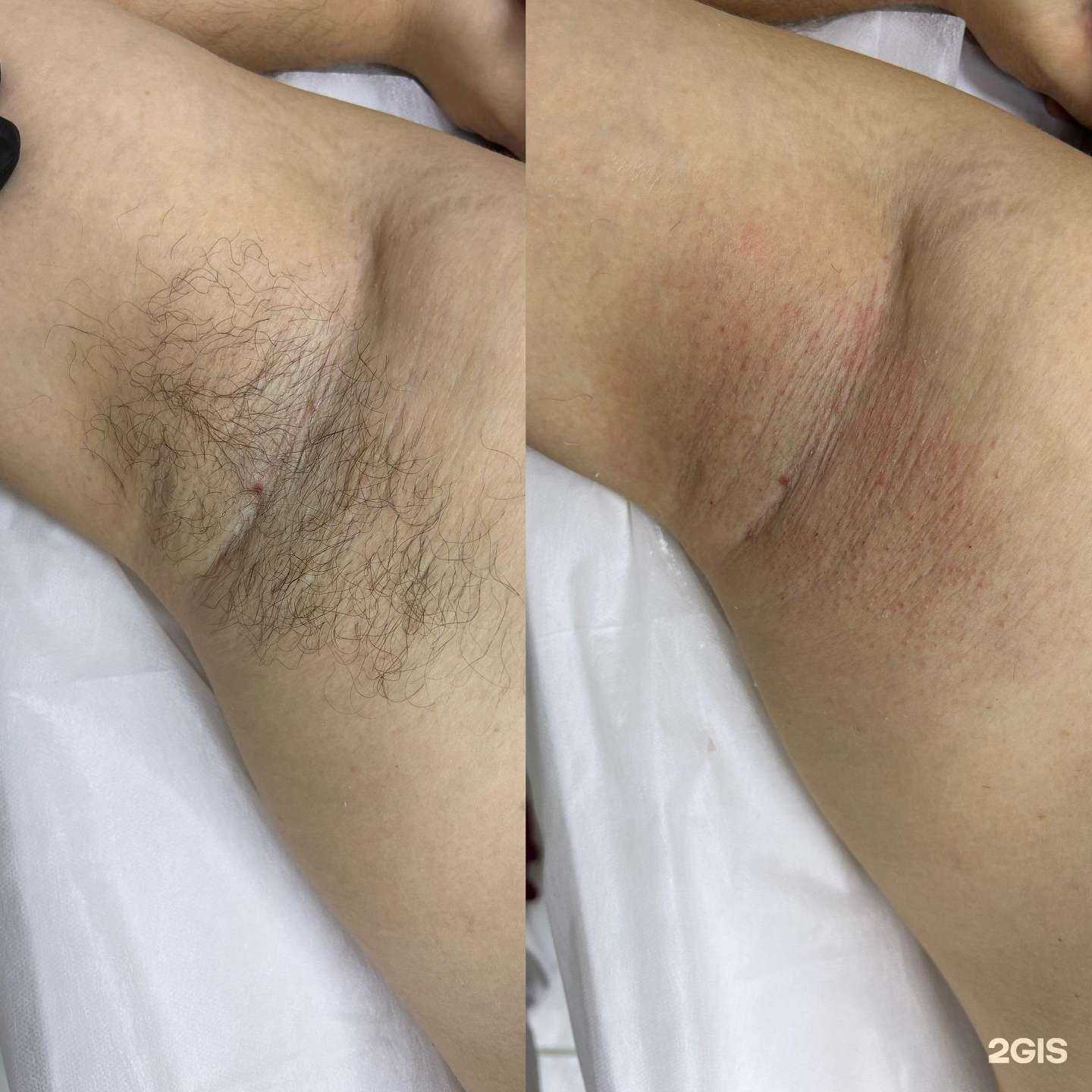 Отзывы на компанию Студия профессиональной депиляции Татьяны Фокс в Краснодаре c фото