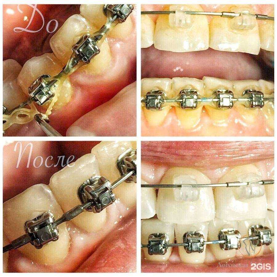 Отзывы на компанию Денталеа в Ростове-на-Дону c фото