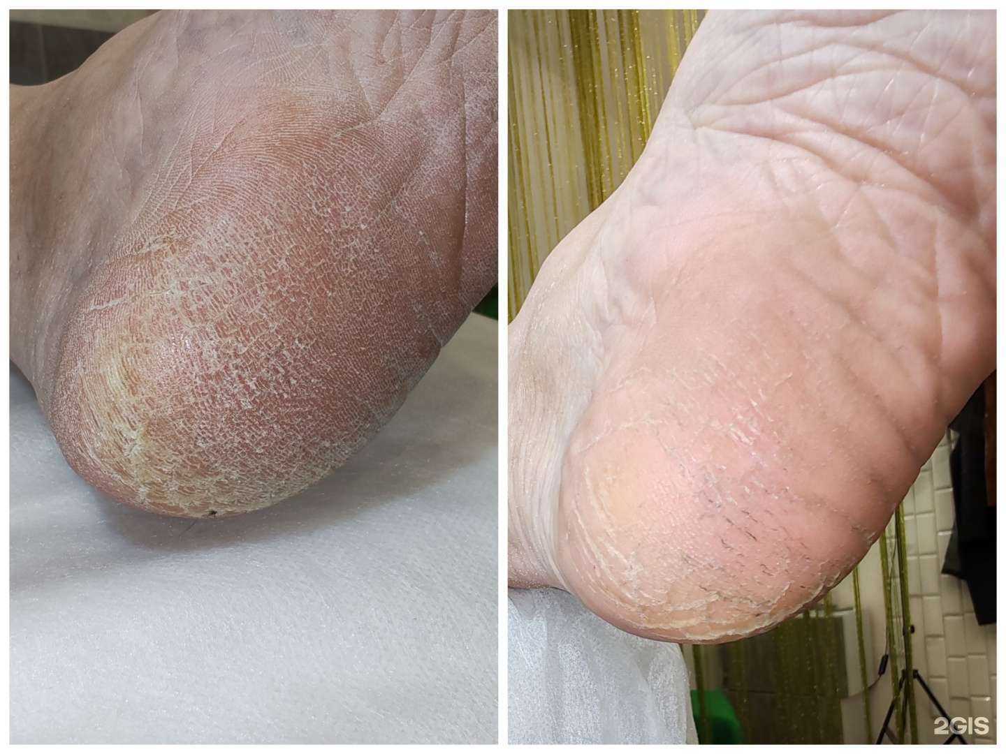 Отзывы на компанию  Подология & здоровая эстетика   в Иркутске c фото