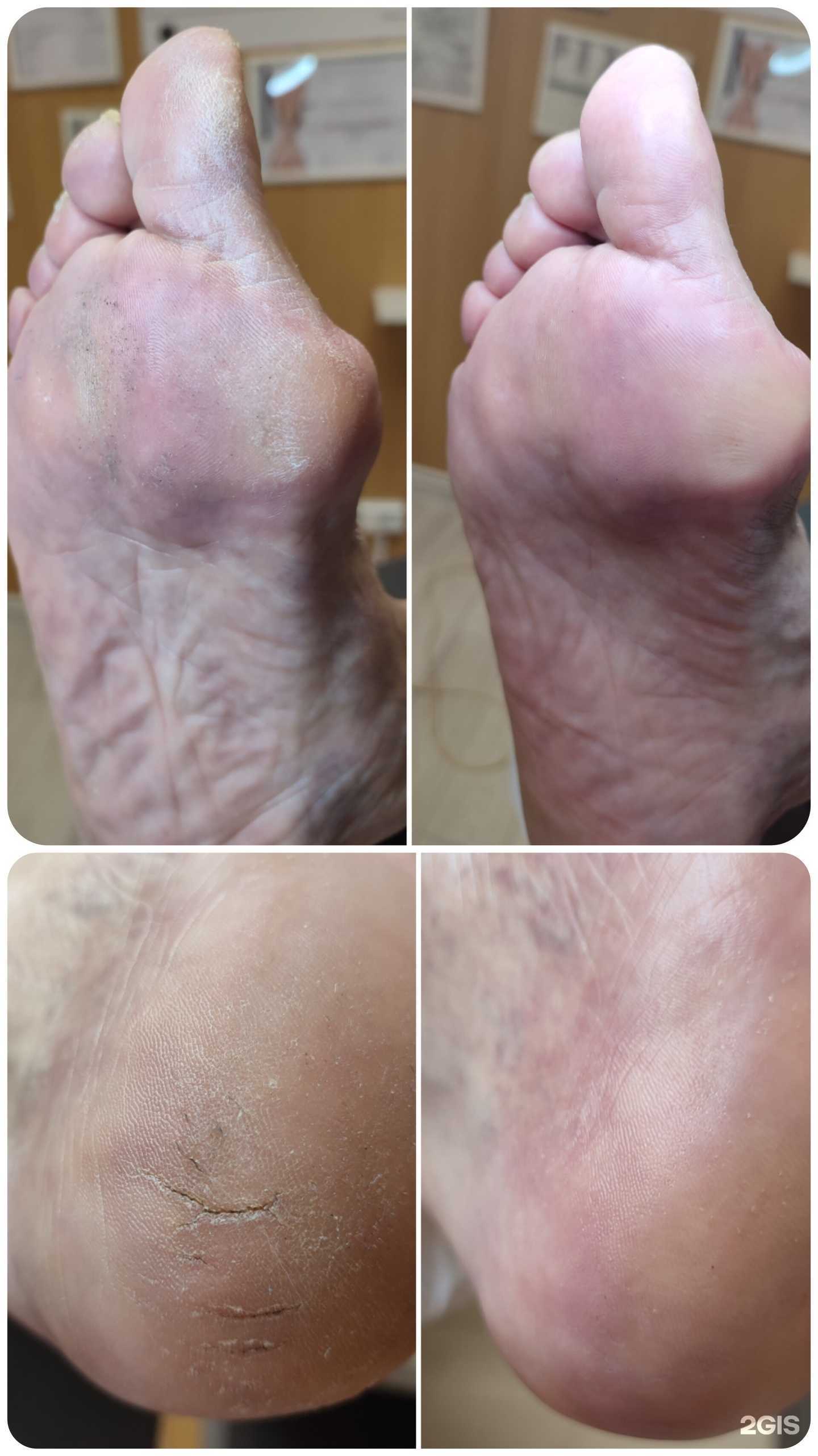 Отзывы на компанию Кабинет здоровых ног в г. Волгоград c фото