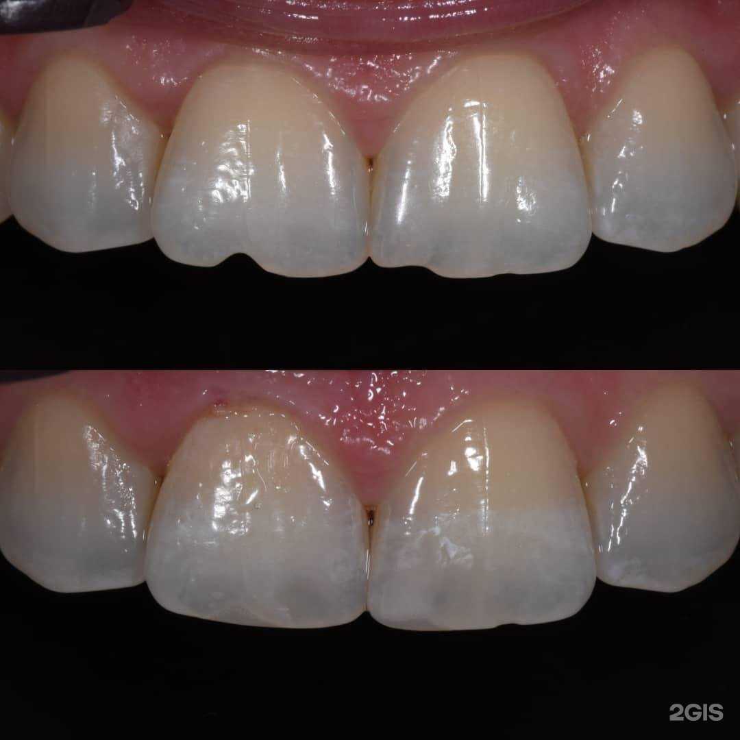 Отзывы на компанию Новая стоматология в Липецке c фото