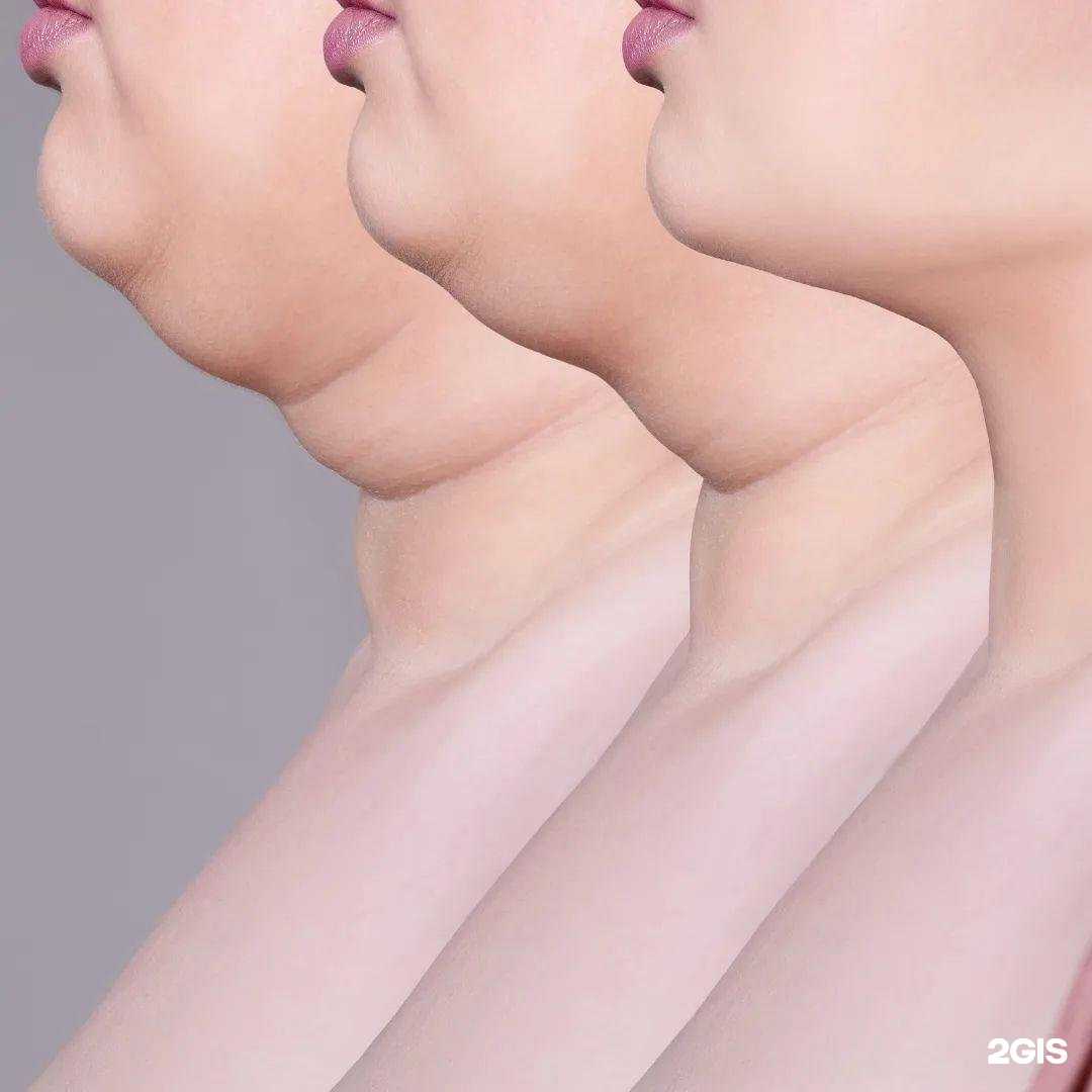 Отзывы на компанию Alonzo skin в Сочи c фото