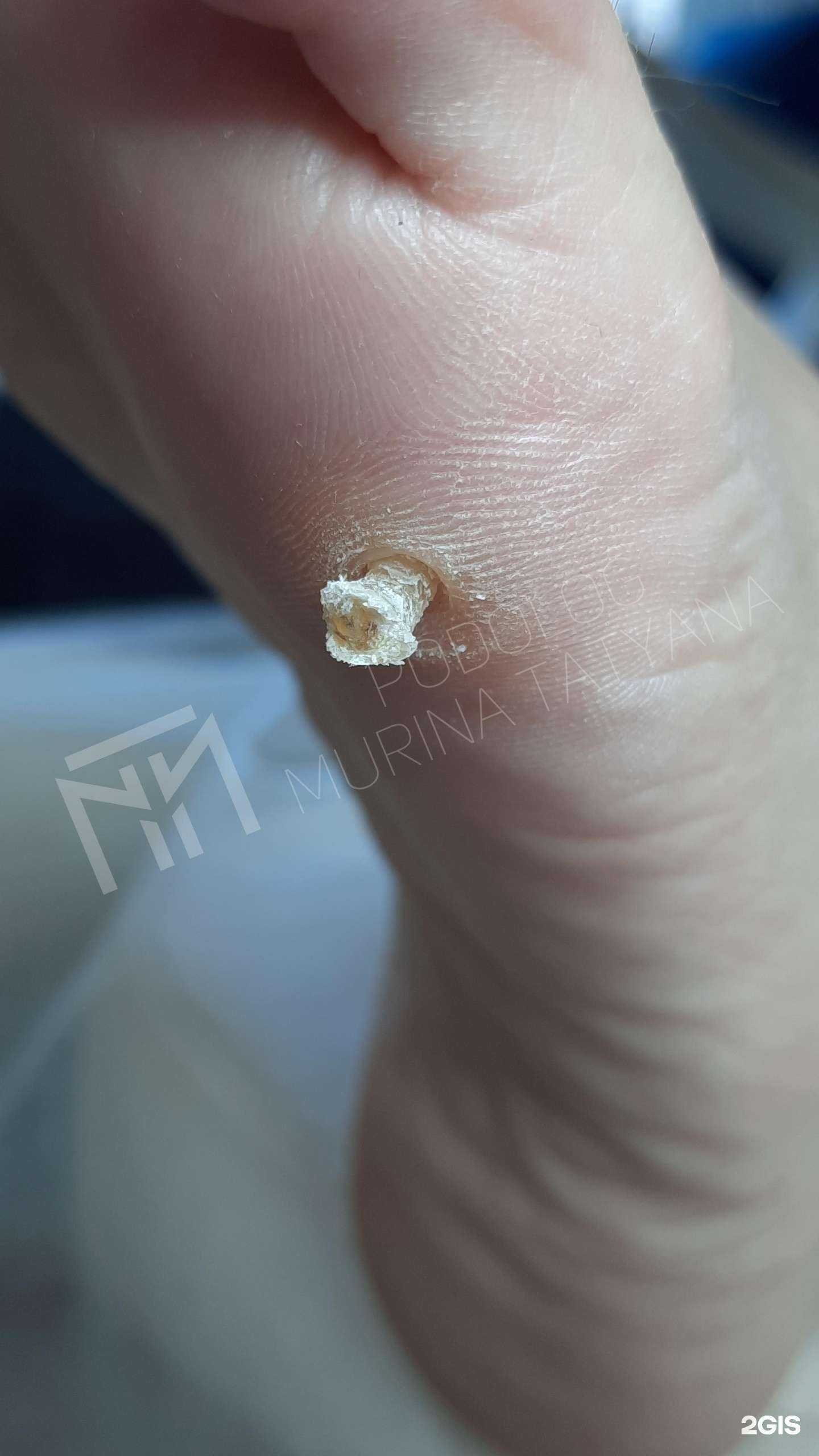 Отзывы на компанию Кабинет подолога в Челябинске c фото