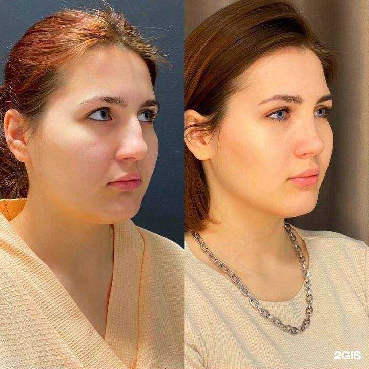 Отзывы на компанию А2мед в Самаре c фото