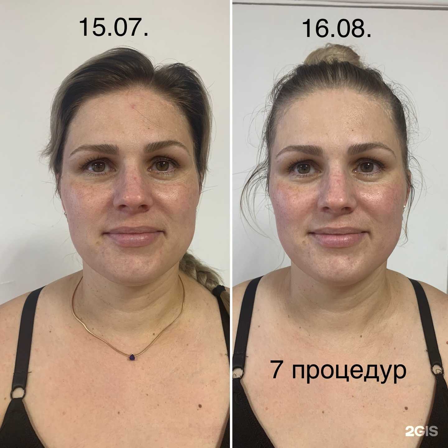 Отзывы на компанию Кабинет Lpg массажа в Артёме c фото