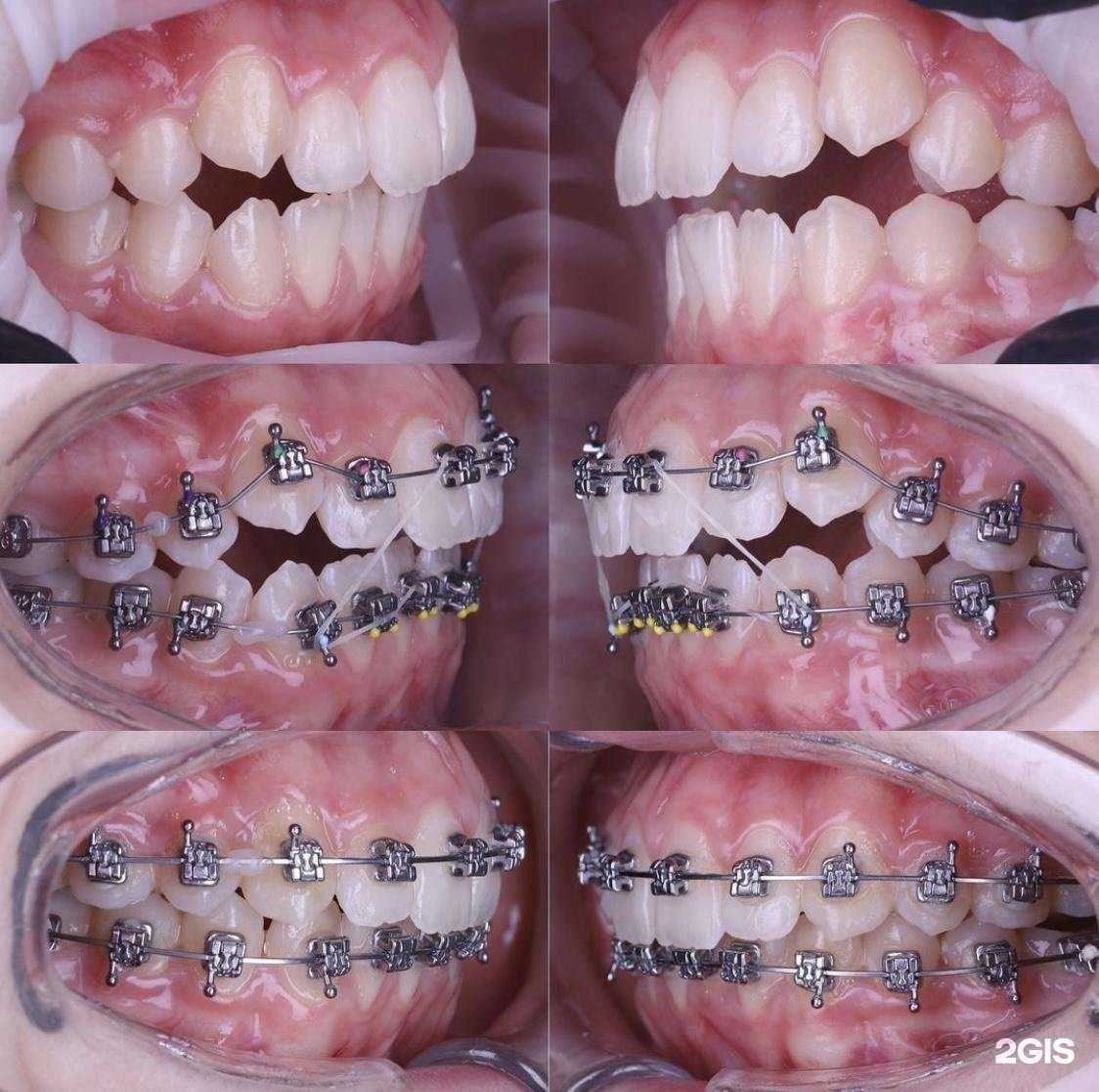 Отзывы на компанию Центр Установки Брекетов в г. Махачкала c фото