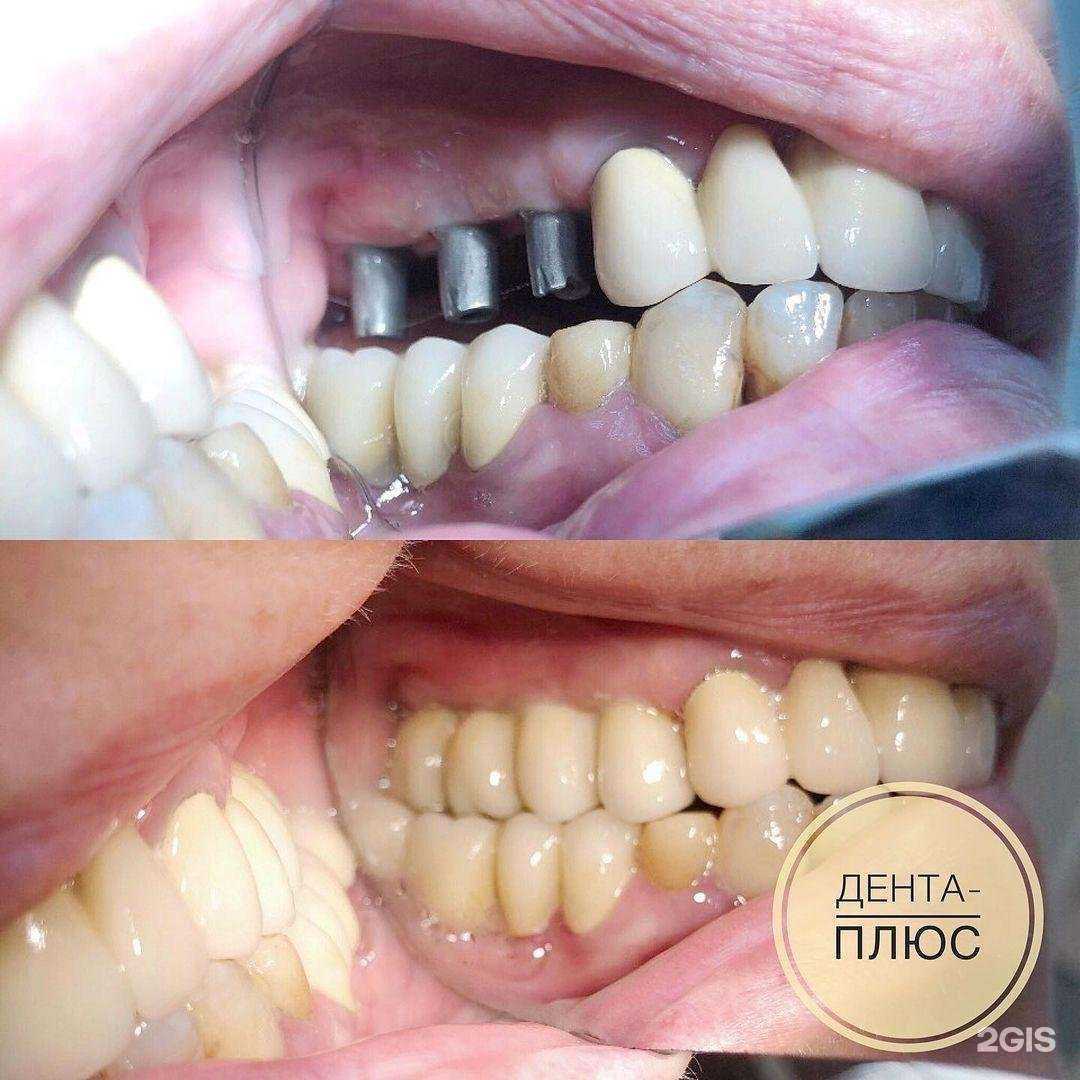 Отзывы на компанию Дента-плюс в Тутаеве c фото