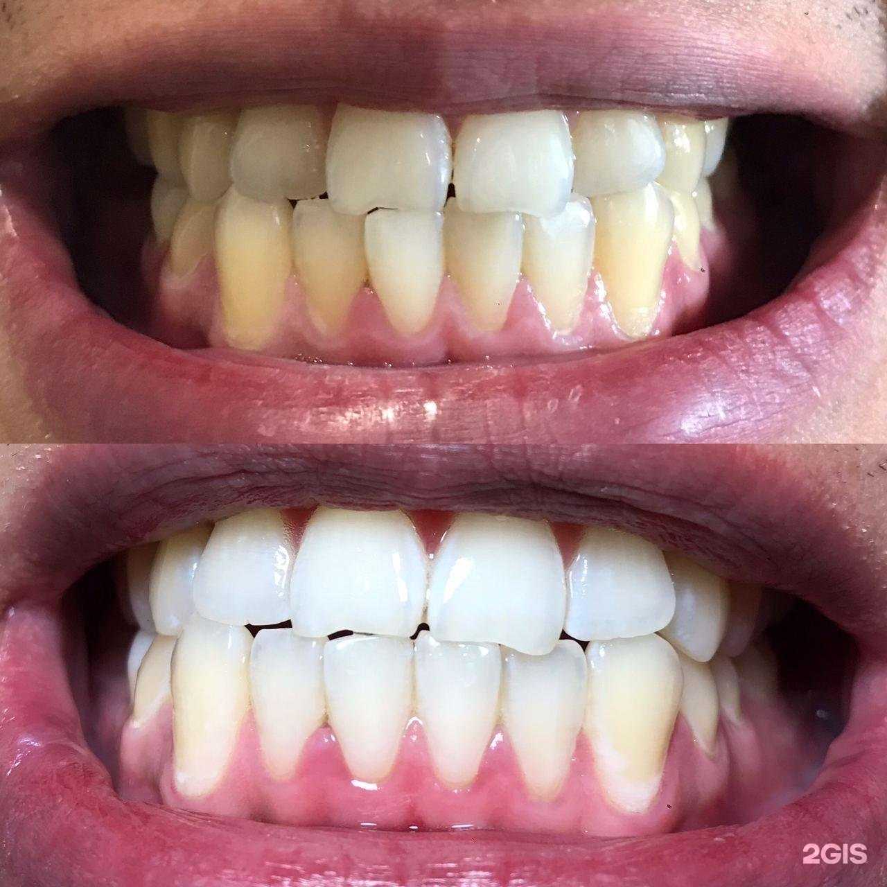 Отзывы на компанию White&Smile в г. Уфа c фото