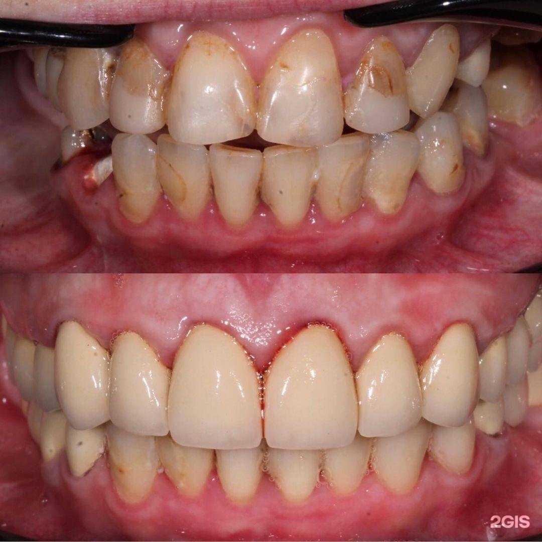 Отзывы на компанию ЭлитДент в г. Навашино c фото